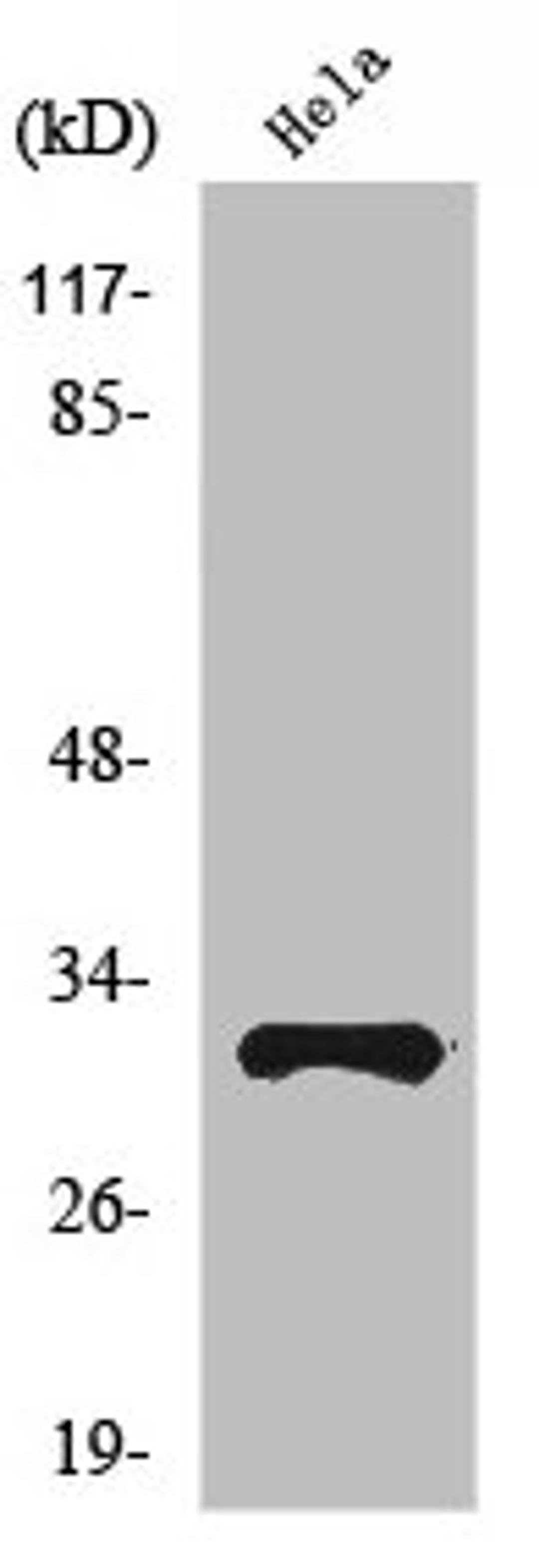Western Blot analysis of HeLa cells using Ribosomal Protein S6 Polyclonal Antibody