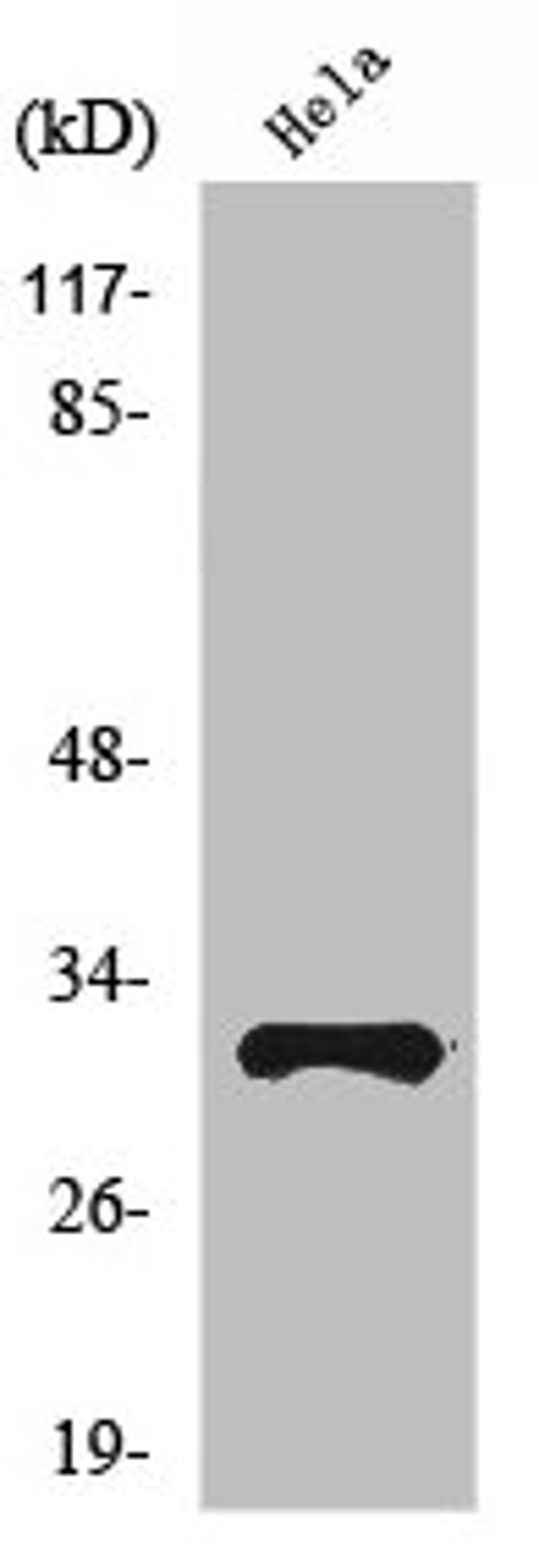 Western Blot analysis of HeLa cells using Ribosomal Protein S6 Polyclonal Antibody