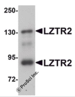 Western blot analysis of LZTR2 in mouse kidney tissue lysate with LZTR2 antibody at 1 &#956;g/mL.