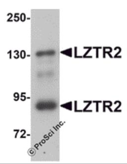 Western blot analysis of LZTR2 in mouse kidney tissue lysate with LZTR2 antibody at 1 μg/mL.