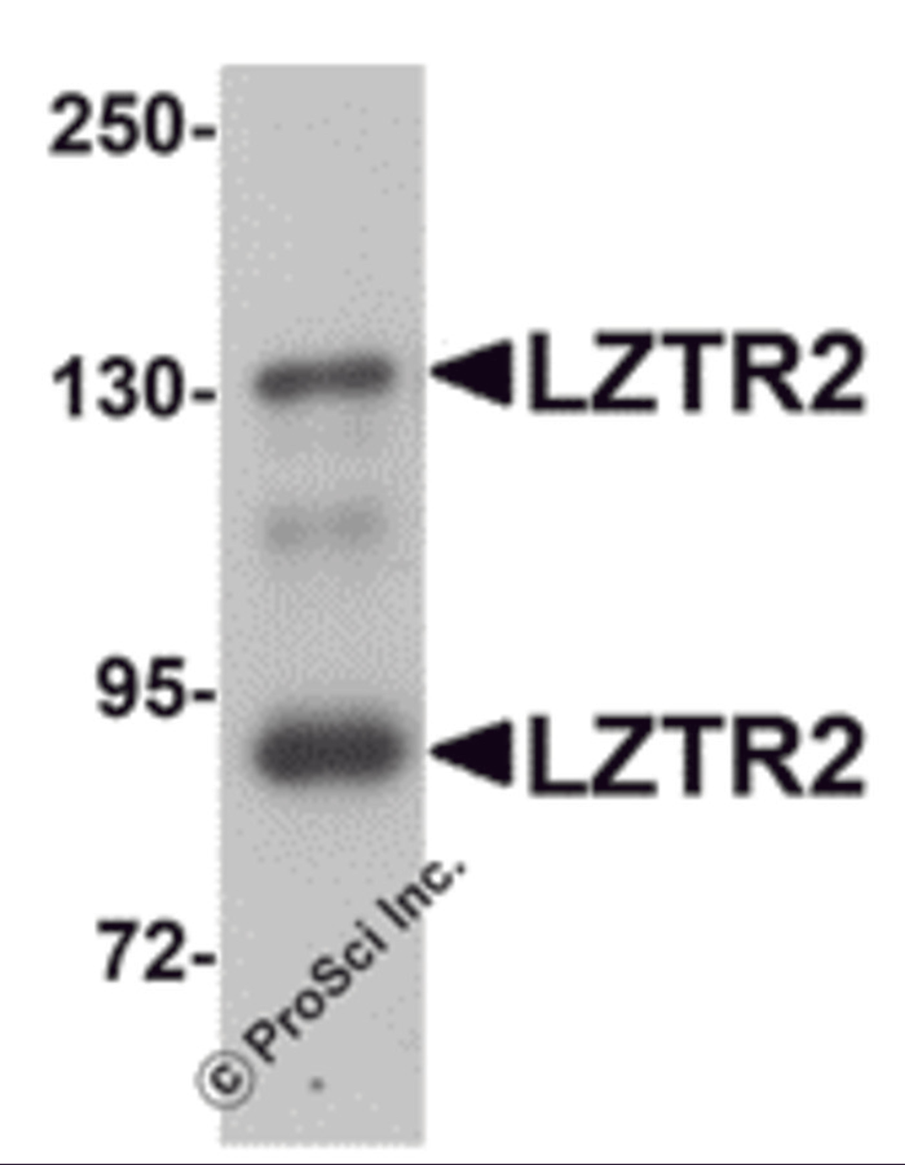 Western blot analysis of LZTR2 in mouse kidney tissue lysate with LZTR2 antibody at 1 μg/mL.