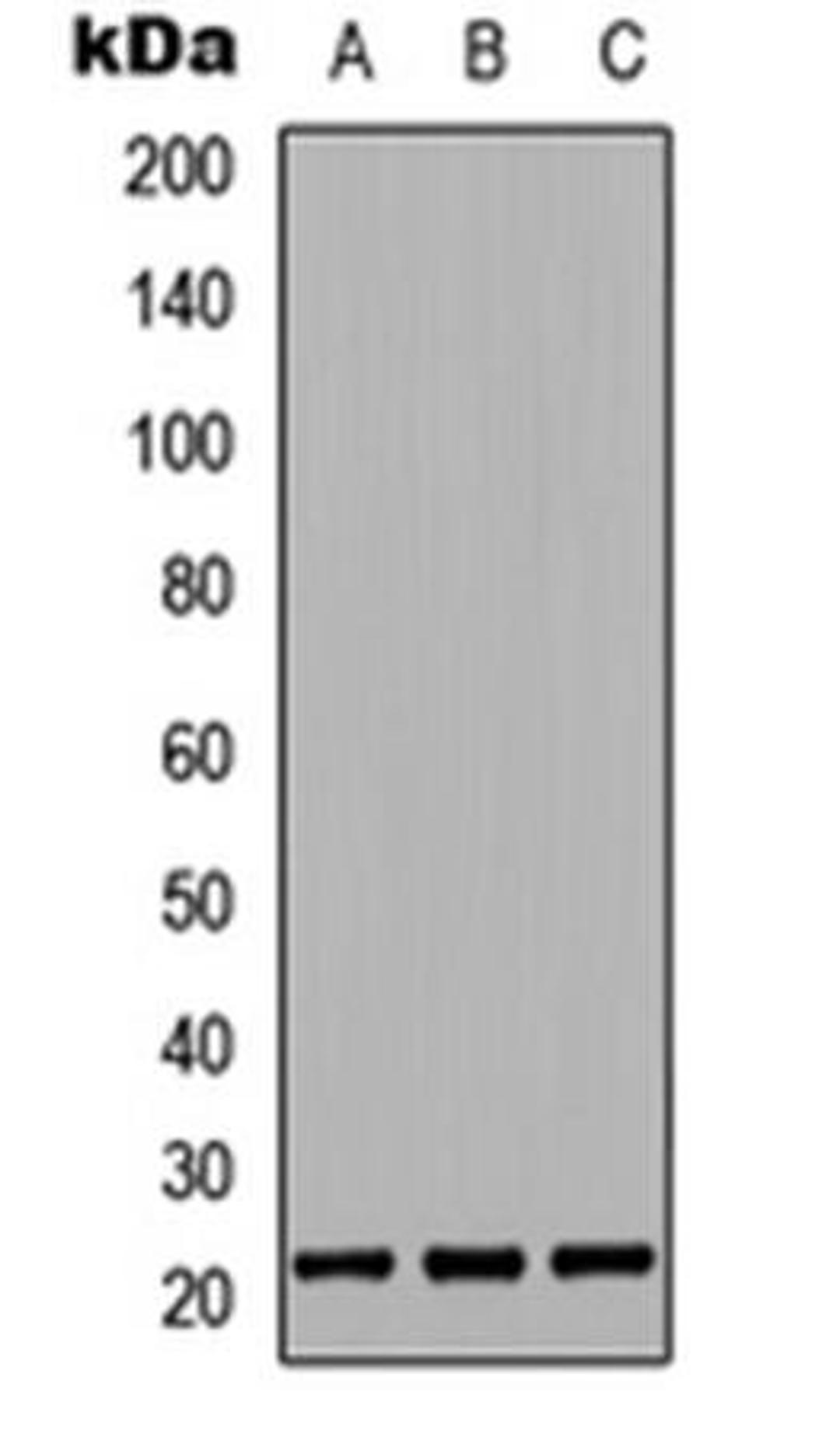 Western blot analysis of HeLa (Lane1), Raw264.7 (Lane2), PC12 (Lane3) whole cell using G-CSF antibody