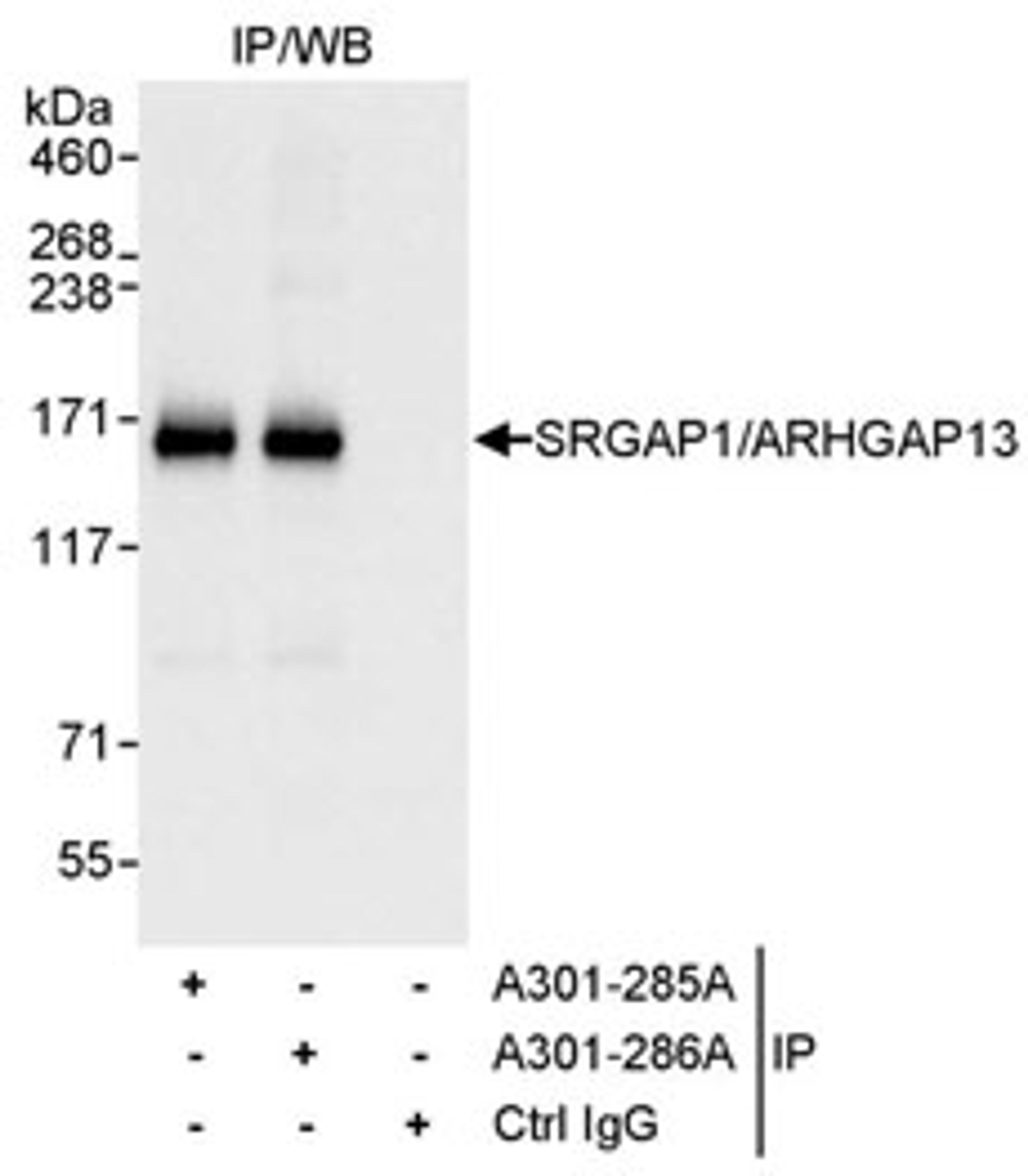 Detection of human SRGAP1/ARHGAP13 by western blot of immunoprecipitates.