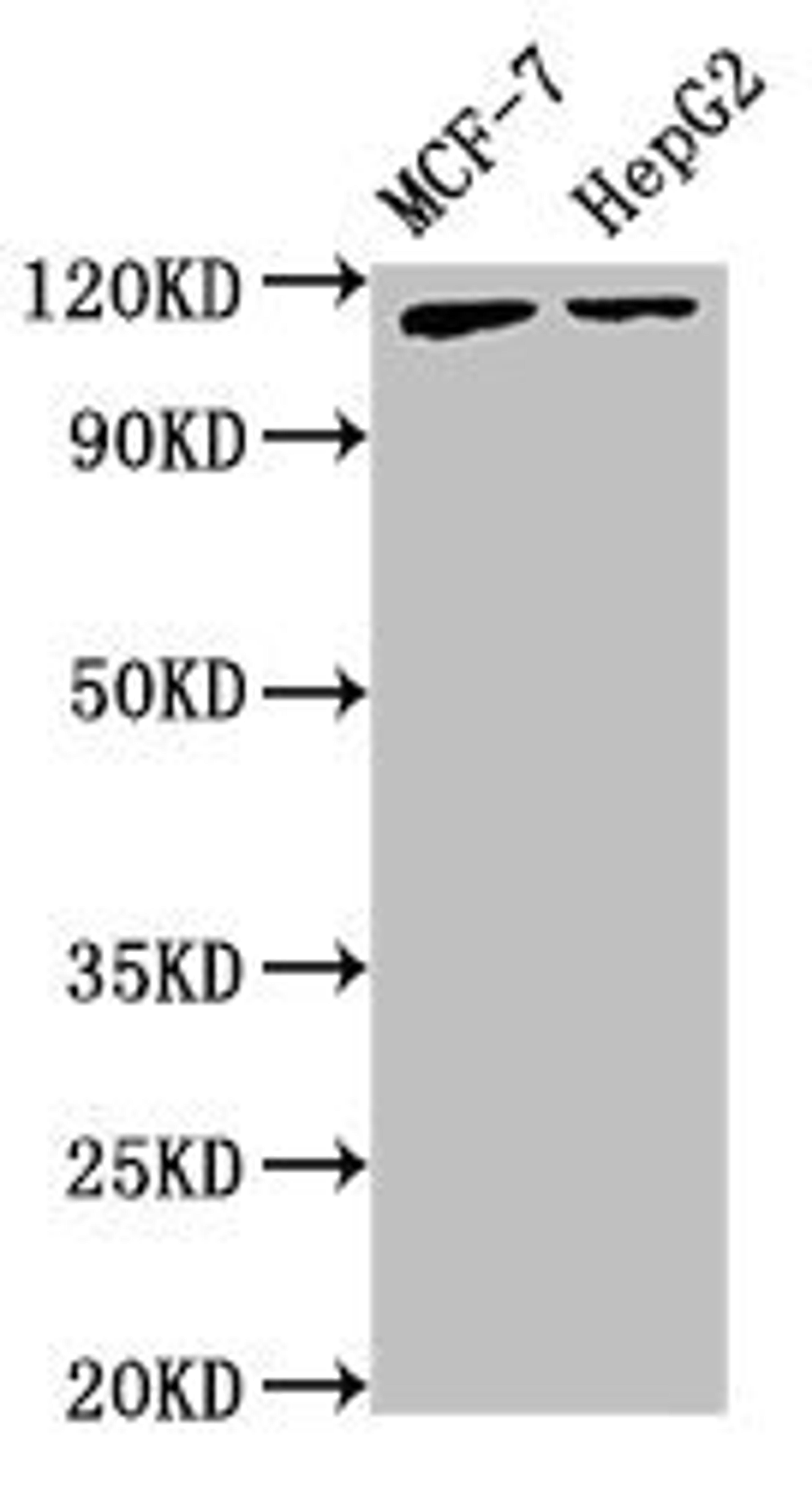 Western blot analysis of MCF-7(lane 1), HepG2(lane 2) whole cell lysate using ATP9A antibody