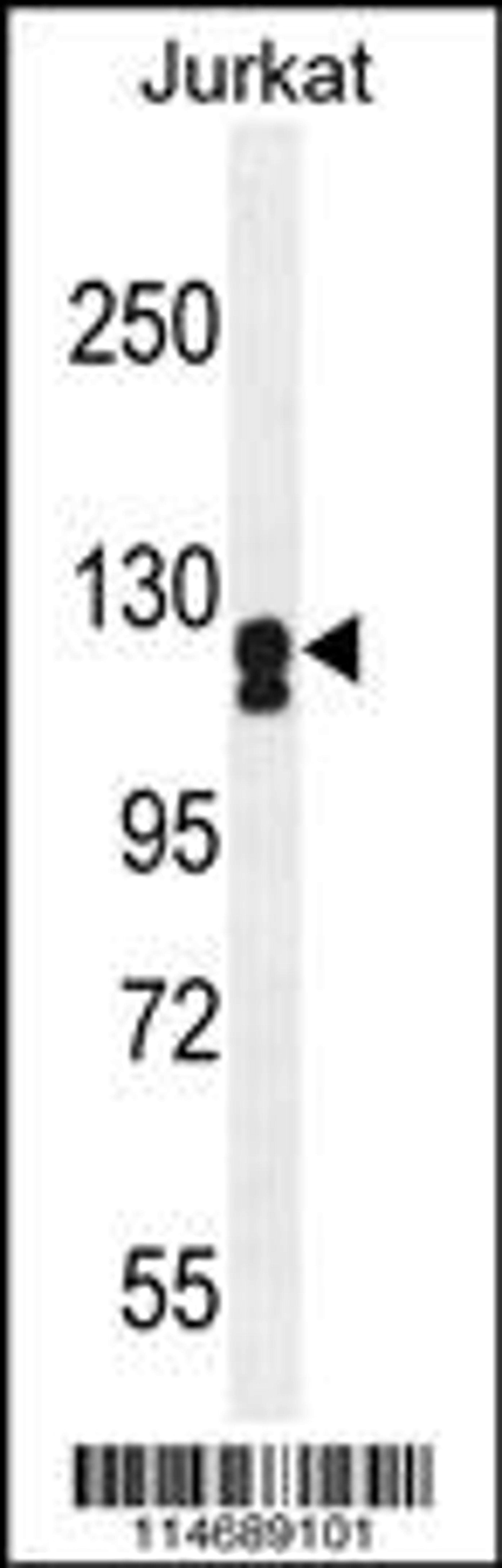 Western blot analysis in Jurkat cell line lysates (35ug/lane).