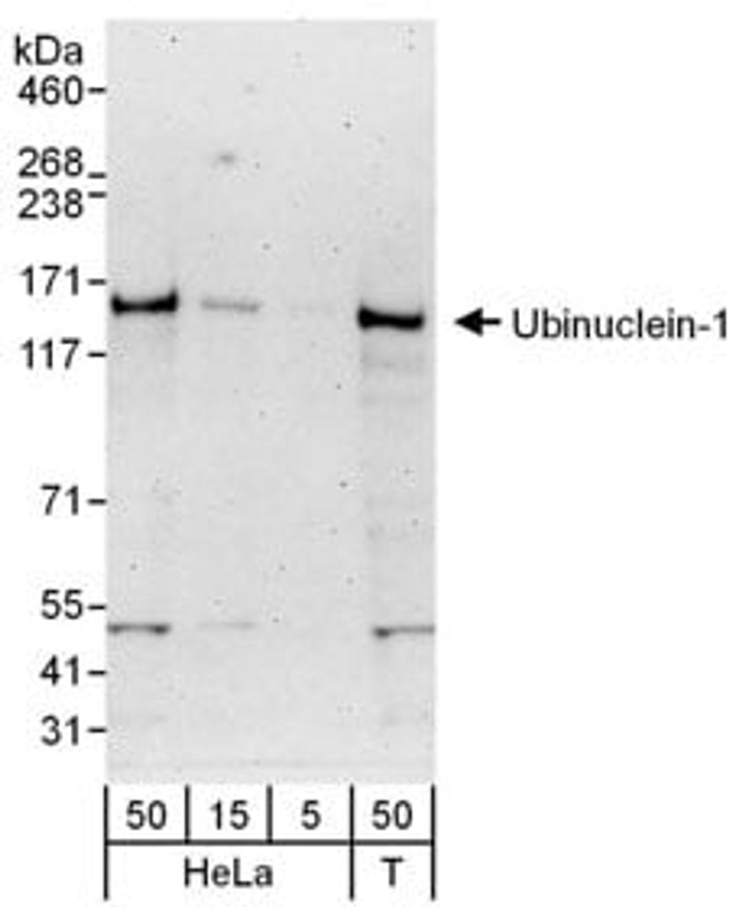 Detection of human Ubinuclein-1 by western blot.