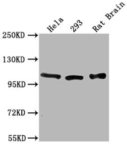 Western Blot. Positive WB detected in: Hela whole cell lysate, 293 whole cell lysate, Rat Brain tissue. All lanes: ACTN2 antibody at 1:2000. Secondary. Goat polyclonal to rabbit IgG at 1/50000 dilution. Predicted band size: 104 kDa. Observed band size: 104 kDa.