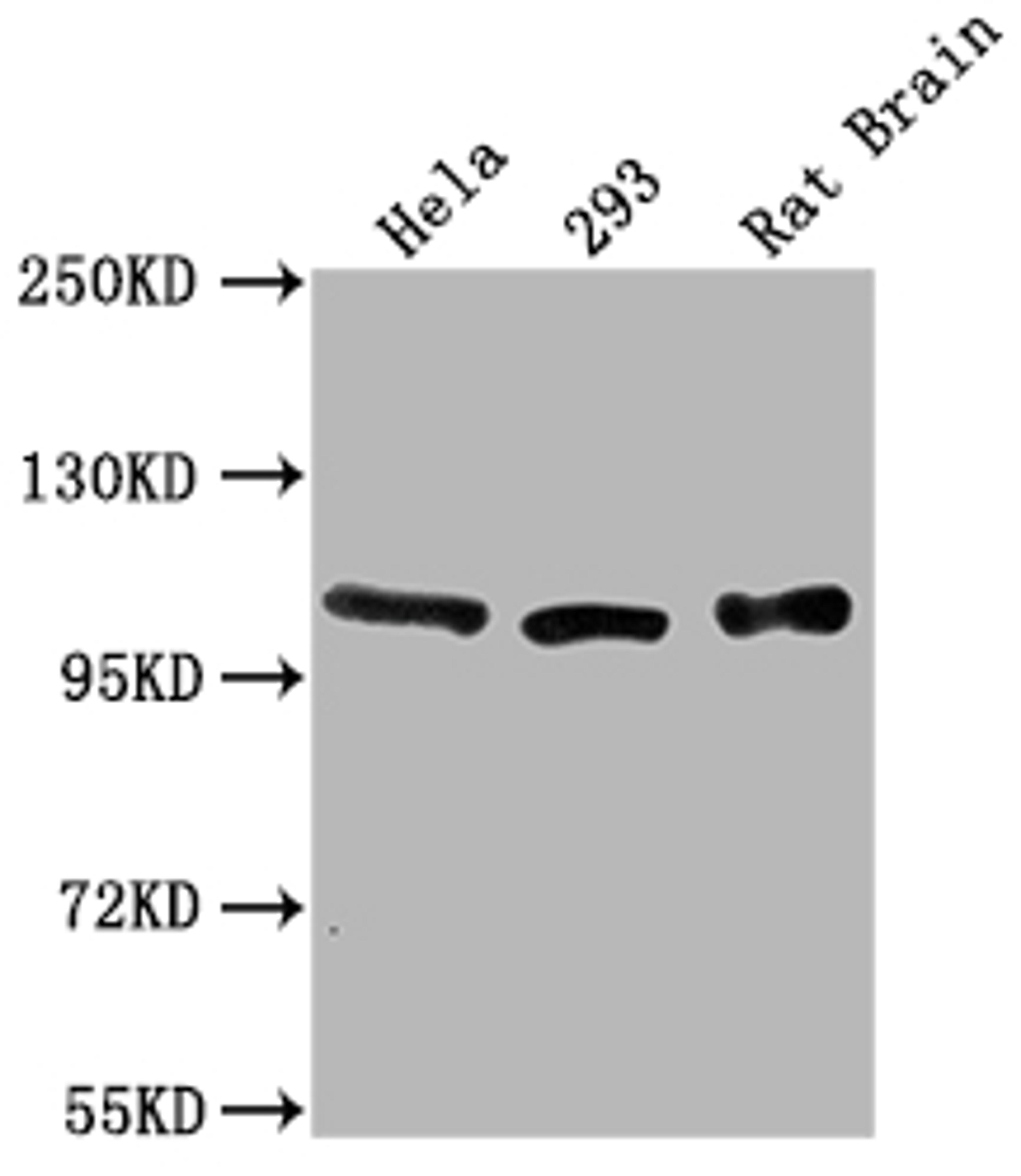 Western Blot. Positive WB detected in: Hela whole cell lysate, 293 whole cell lysate, Rat Brain tissue. All lanes: ACTN2 antibody at 1:2000. Secondary. Goat polyclonal to rabbit IgG at 1/50000 dilution. Predicted band size: 104 kDa. Observed band size: 104 kDa.