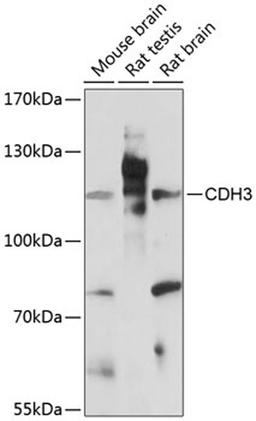 Western blot - CDH3 antibody (A14235)