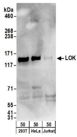 Detection of human LOK by western blot.