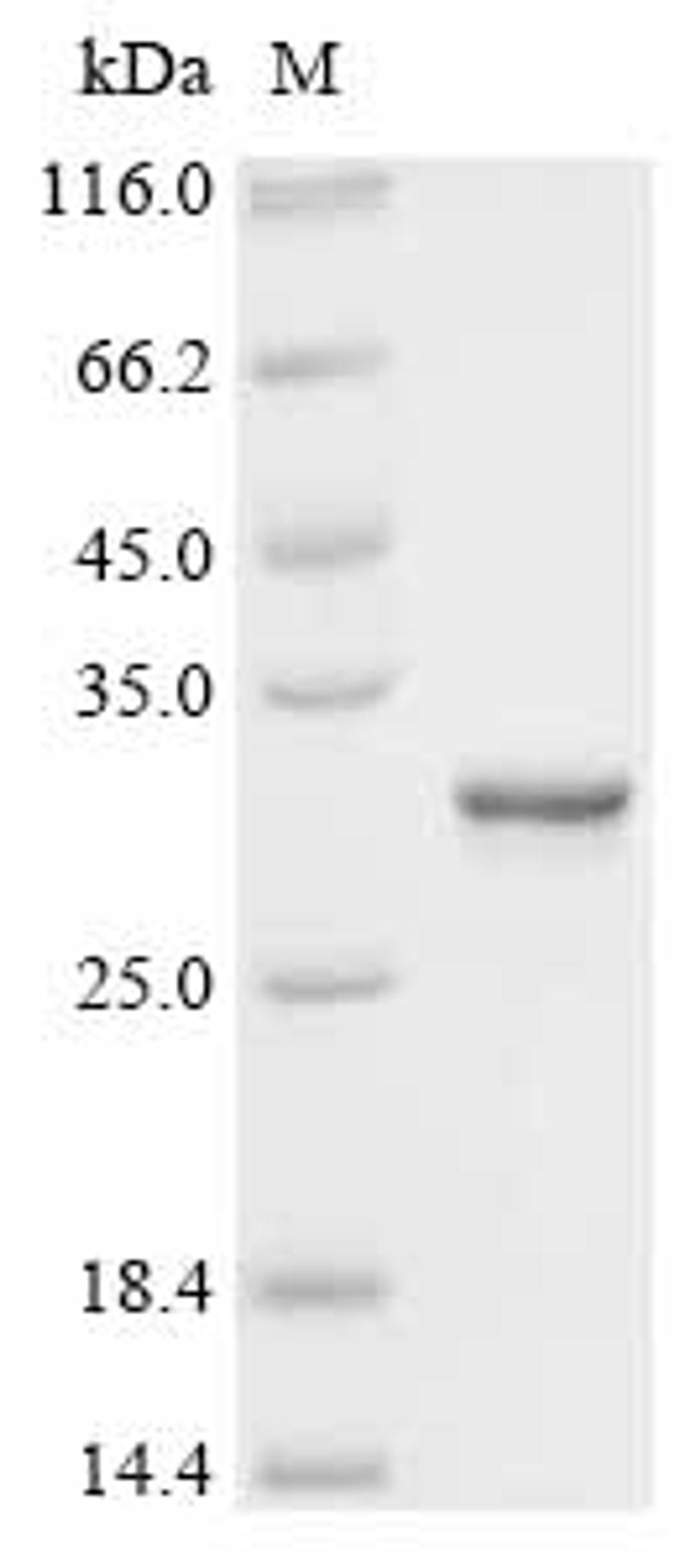 (Tris-Glycine gel) Discontinuous SDS-PAGE (reduced) with 5% enrichment gel and 15% separation gel.