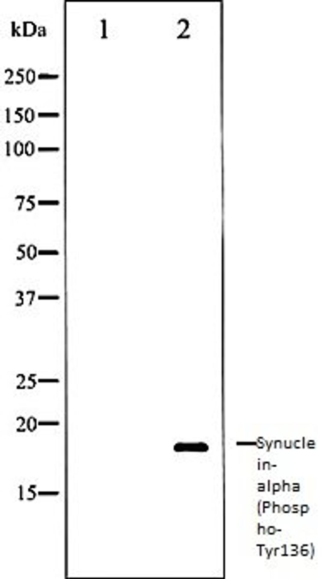 Western blot analysis of Mouse brain tissue lysates using Synuclein- alpha (Phospho-Tyr136) antibody, The lane on the left is treated with the antigen-specific peptide.