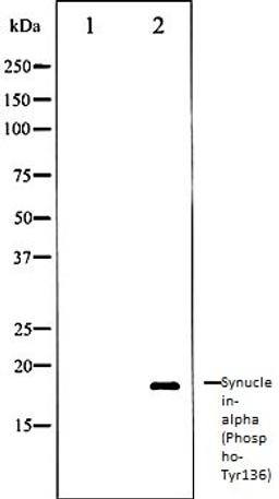 Western blot analysis of Mouse brain tissue lysates using Synuclein- alpha (Phospho-Tyr136) antibody, The lane on the left is treated with the antigen-specific peptide.