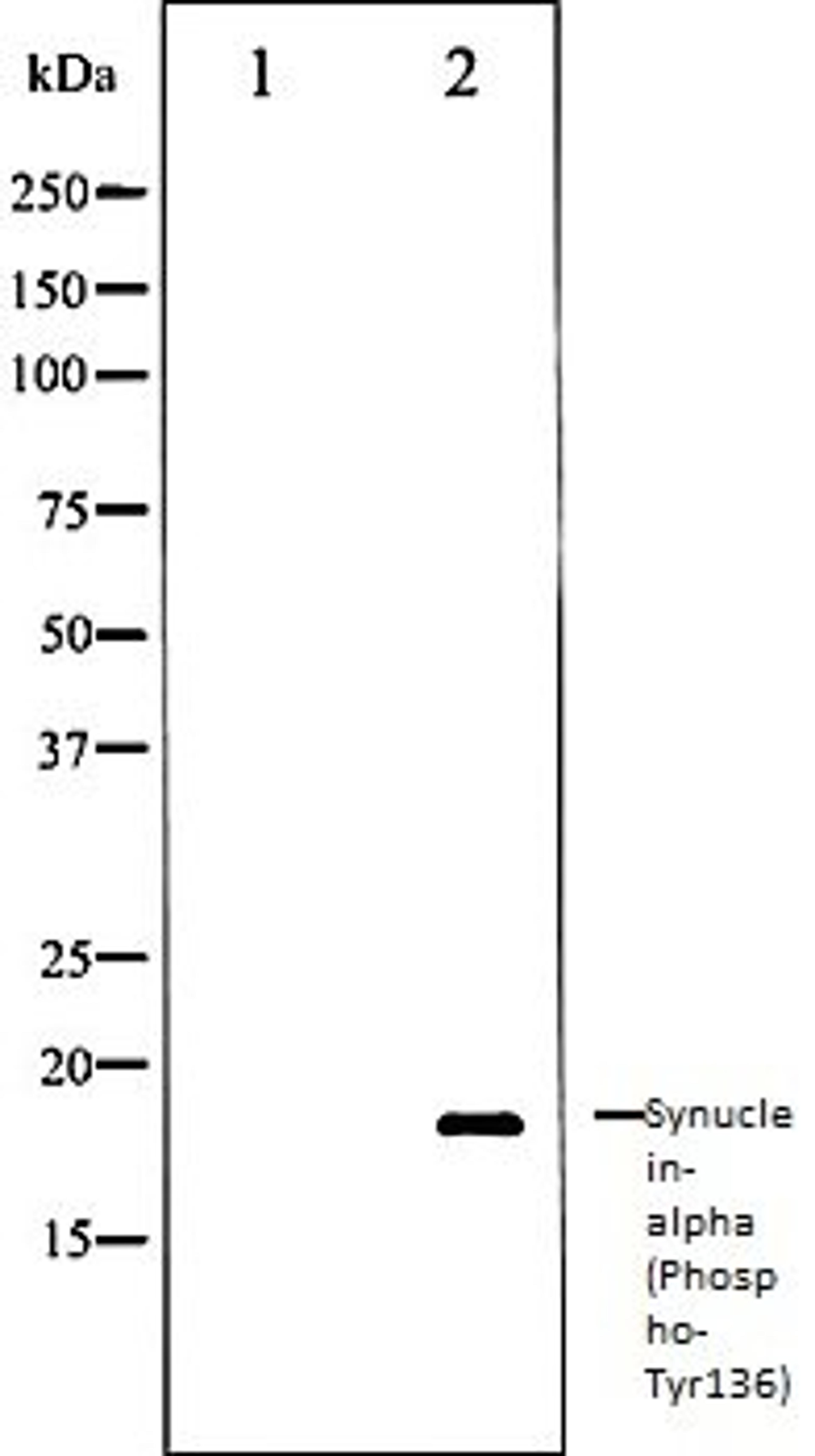 Western blot analysis of Mouse brain tissue lysates using Synuclein- alpha (Phospho-Tyr136) antibody, The lane on the left is treated with the antigen-specific peptide.