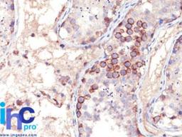 Immunohistochemistry-Paraffin: MAGE 1 Antibody (MA454) [NBP2-29469] - Formalin-fixed, paraffin-embedded human testis stained with MAGE-1 antibody (1:200), peroxidase-conjugate and DAB chromogen.