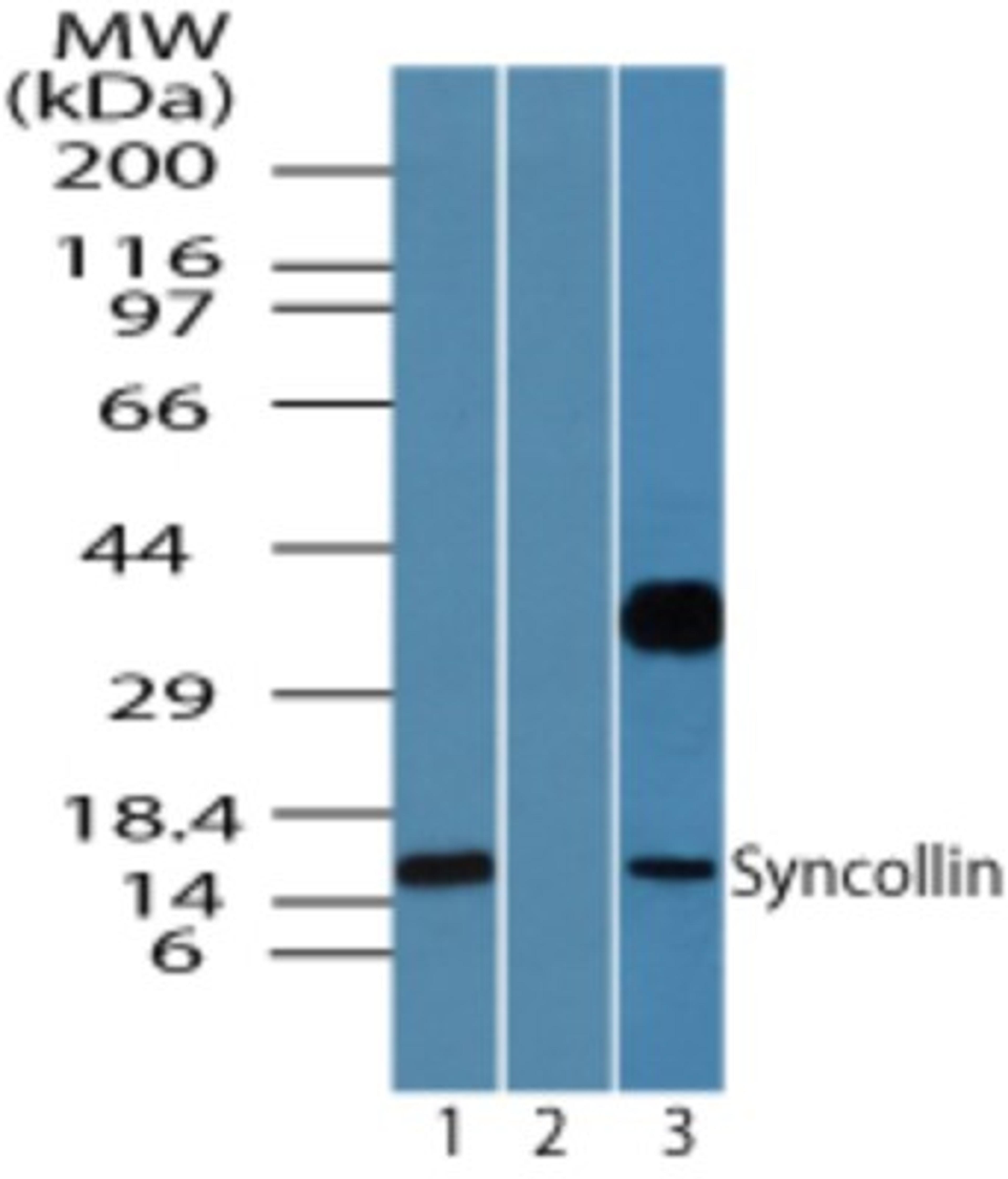 Western Blot: Syncollin Antibody [NBP2-24491] - Western blot analysis of syncollin in human pancreas lysate in the 1) absence and 2) presence of immunizing peptide and 3) rat pancreas using NBP2-24491 at 0.05 ug/ml and 2 ug/ml, respectively.