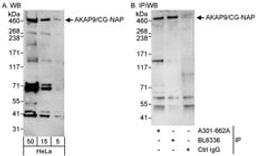 Detection of human AKAP9/CG-NAP by western blot and immunoprecipitation.