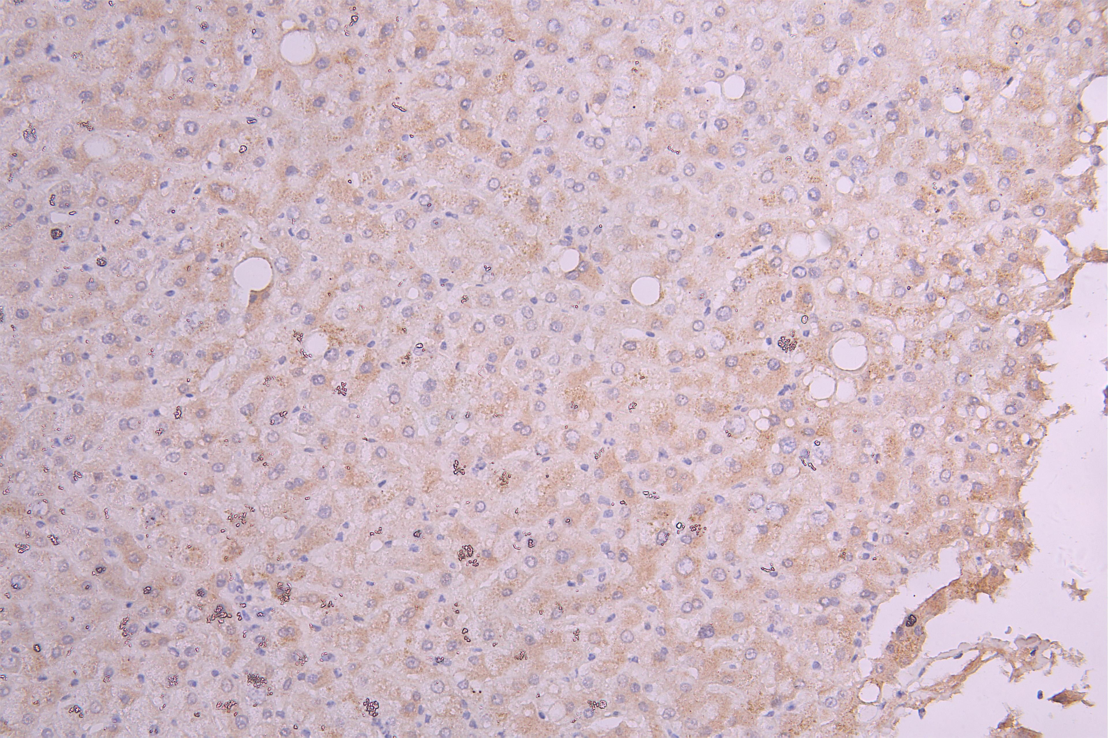 IHC image of CSB-RA356436MA1HU diluted at 1:100 and staining in paraffin-embedded human liver tissue performed on a Leica BondTM system. After dewaxing and hydration, antigen retrieval was mediated by high pressure in a citrate buffer (pH 6.0). Section was blocked with 10% normal goat serum 30min at RT. Then primary antibody (1% BSA) was incubated at 4°C overnight. The primary is detected by a Goat anti-Human IgG labeled by HRP and visualized using 0.05% DAB.