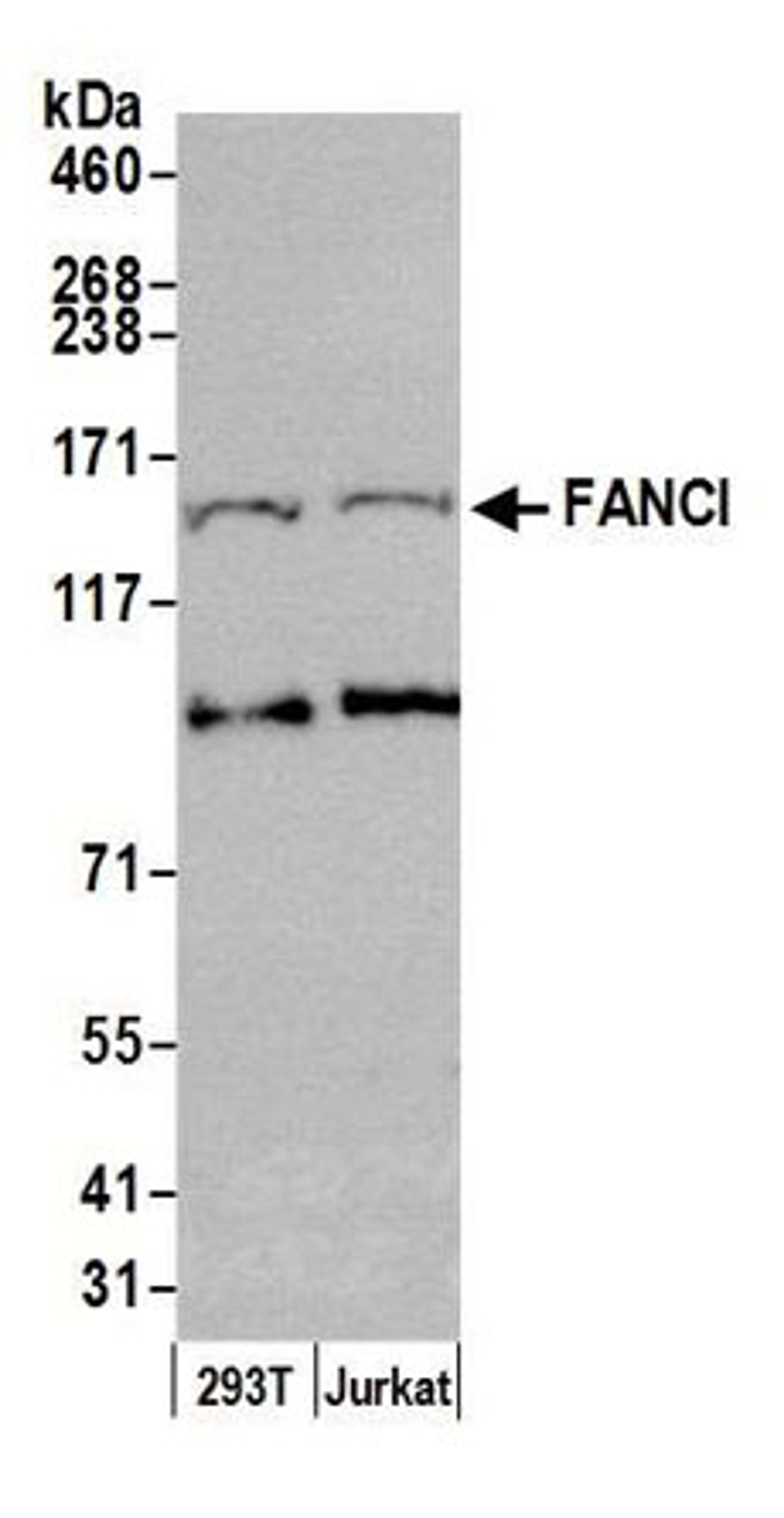 Detection of human FANCI by western blot.