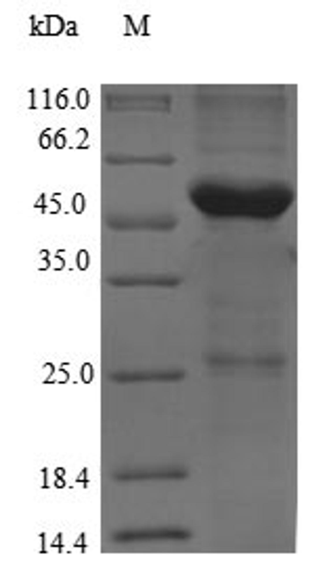 (Tris-Glycine gel) Discontinuous SDS-PAGE (reduced) with 5% enrichment gel and 15% separation gel.