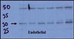 Endothelial cell lysate transferred to membrane was incubated with primary antibody at a 1:500 dilution in 2% BSA in TBST at 4deg C overnight.  Data courtesy of Dr. Katherine Healey, NWCRF Institute, School of Biological Sciences, University of Wales Bang