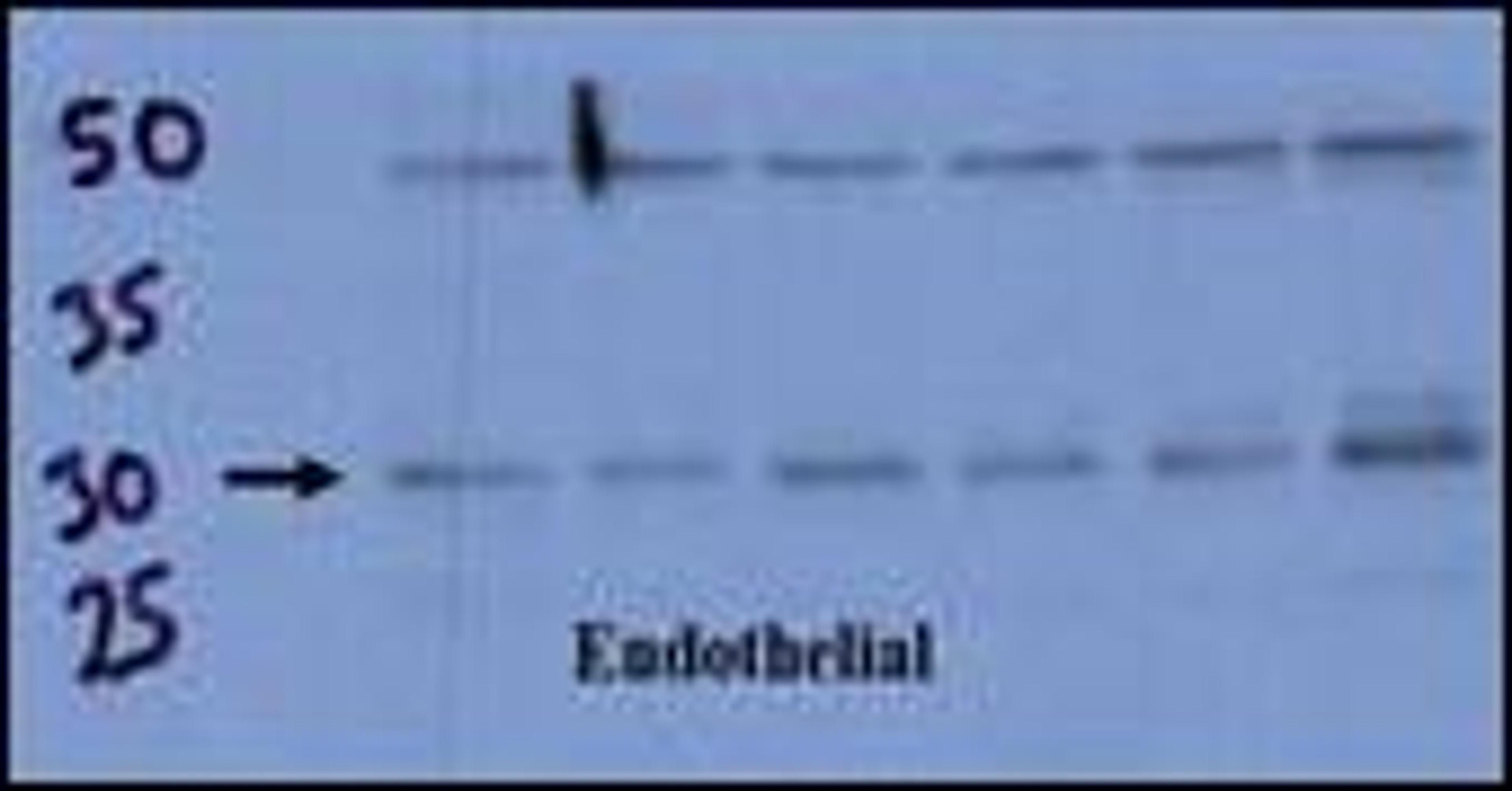 Endothelial cell lysate transferred to membrane was incubated with primary antibody at a 1:500 dilution in 2% BSA in TBST at 4deg C overnight.  Data courtesy of Dr. Katherine Healey, NWCRF Institute, School of Biological Sciences, University of Wales Bang