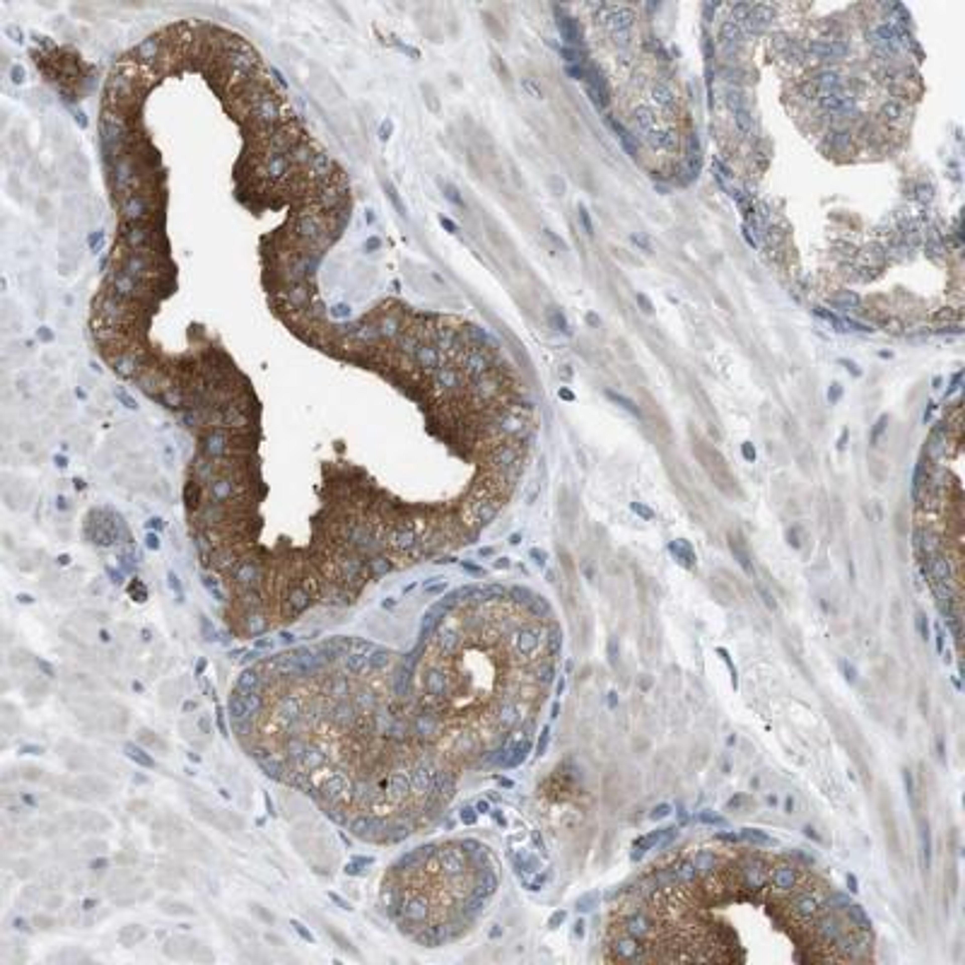 Immunohistochemistry: B4GALNT2 Antibody [NBP1-91229] - Staining of human prostate shows strong cytoplasmic positivity in glandular cells.