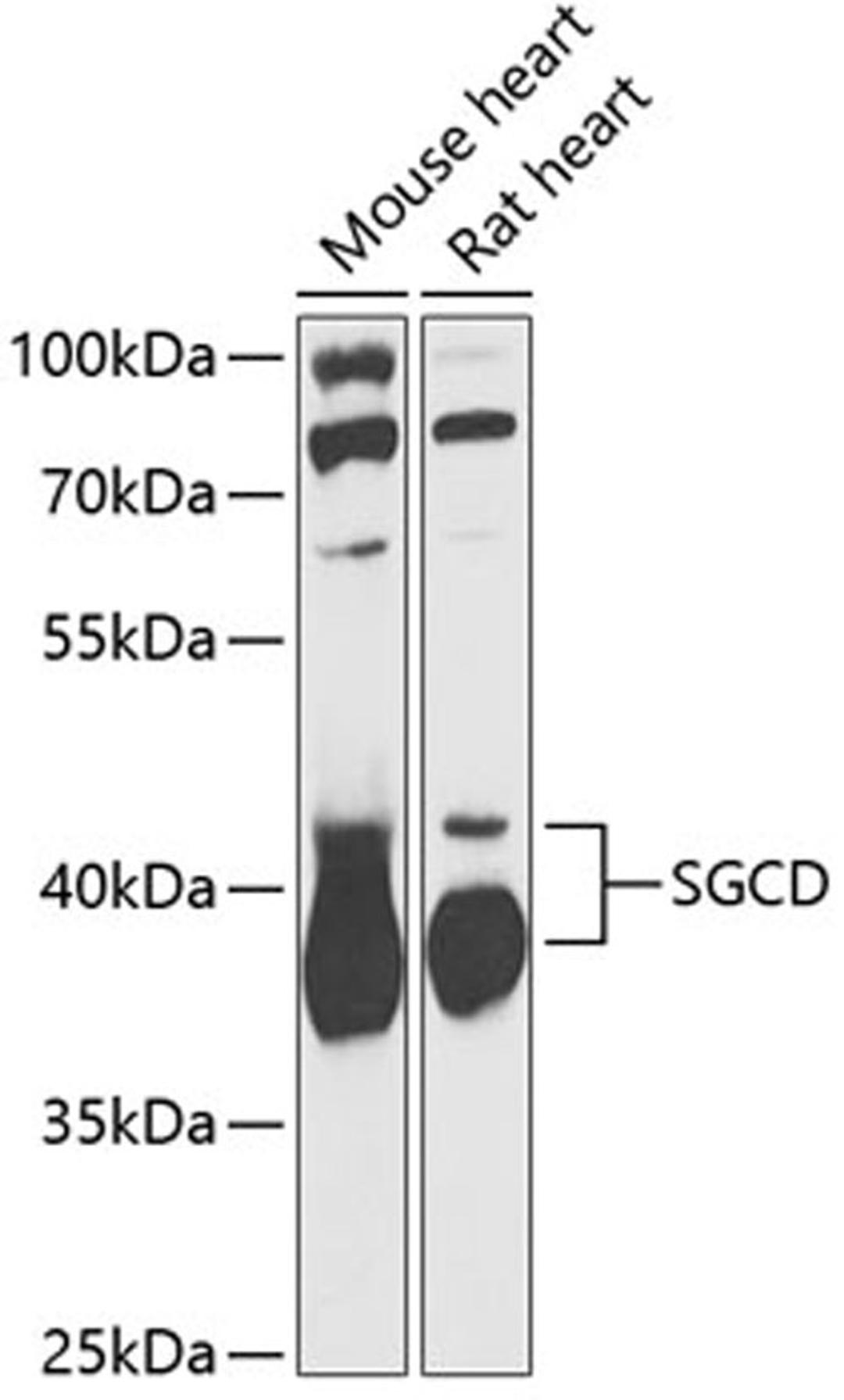 Western blot - SGCD antibody (A13351)