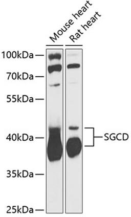 Western blot - SGCD antibody (A13351)