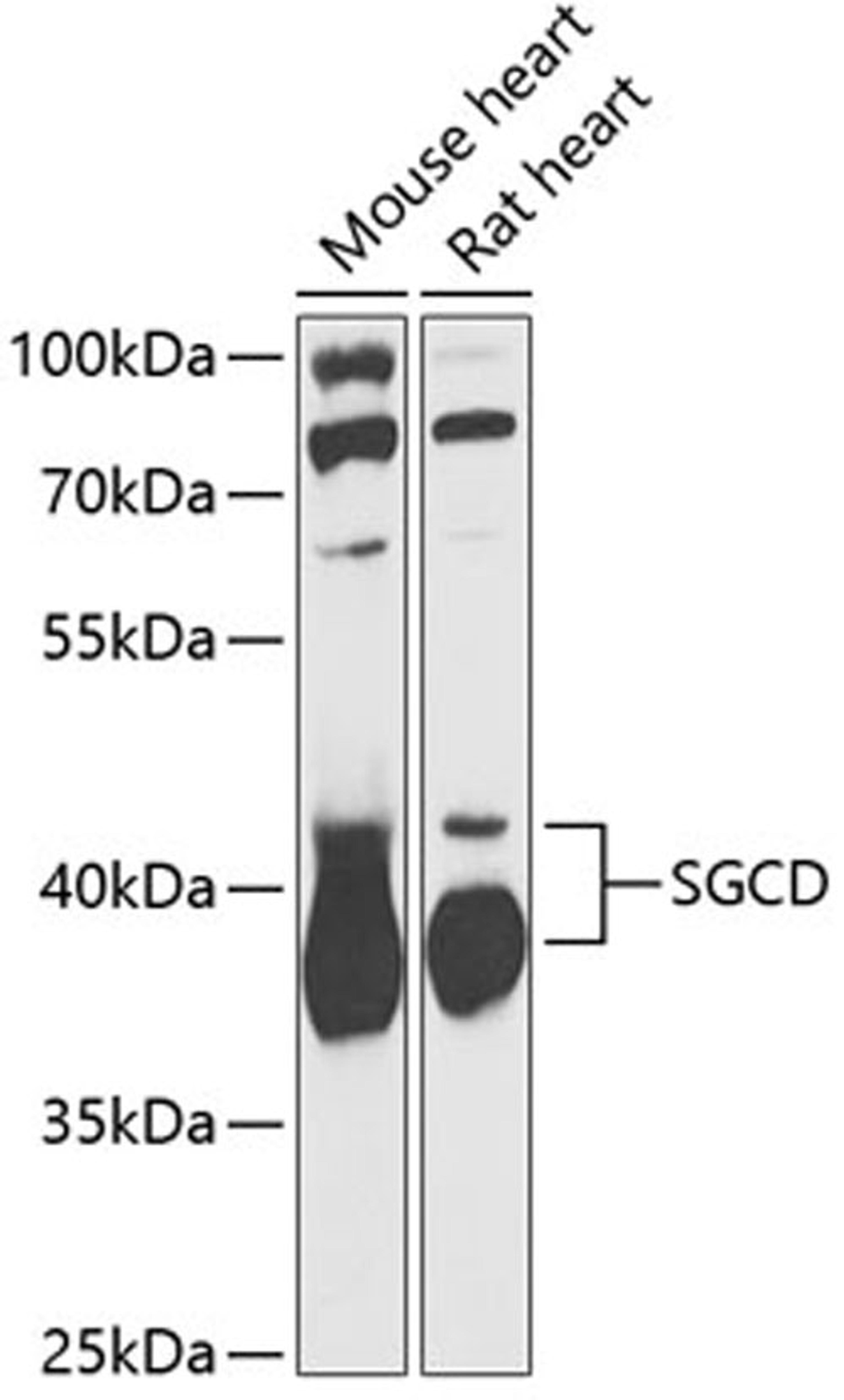 Western blot - SGCD antibody (A13351)