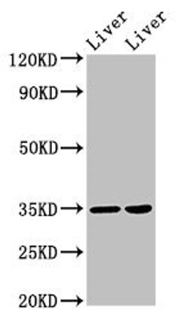 Western Blot. Positive WB detected in: Rat liver tissue, Mouse liver tissue. All lanes: NANOGP8 antibody at 2µg/ml. Secondary. Goat polyclonal to rabbit IgG at 1/50000 dilution. Predicted band size: 35 kDa. Observed band size: 35 kDa