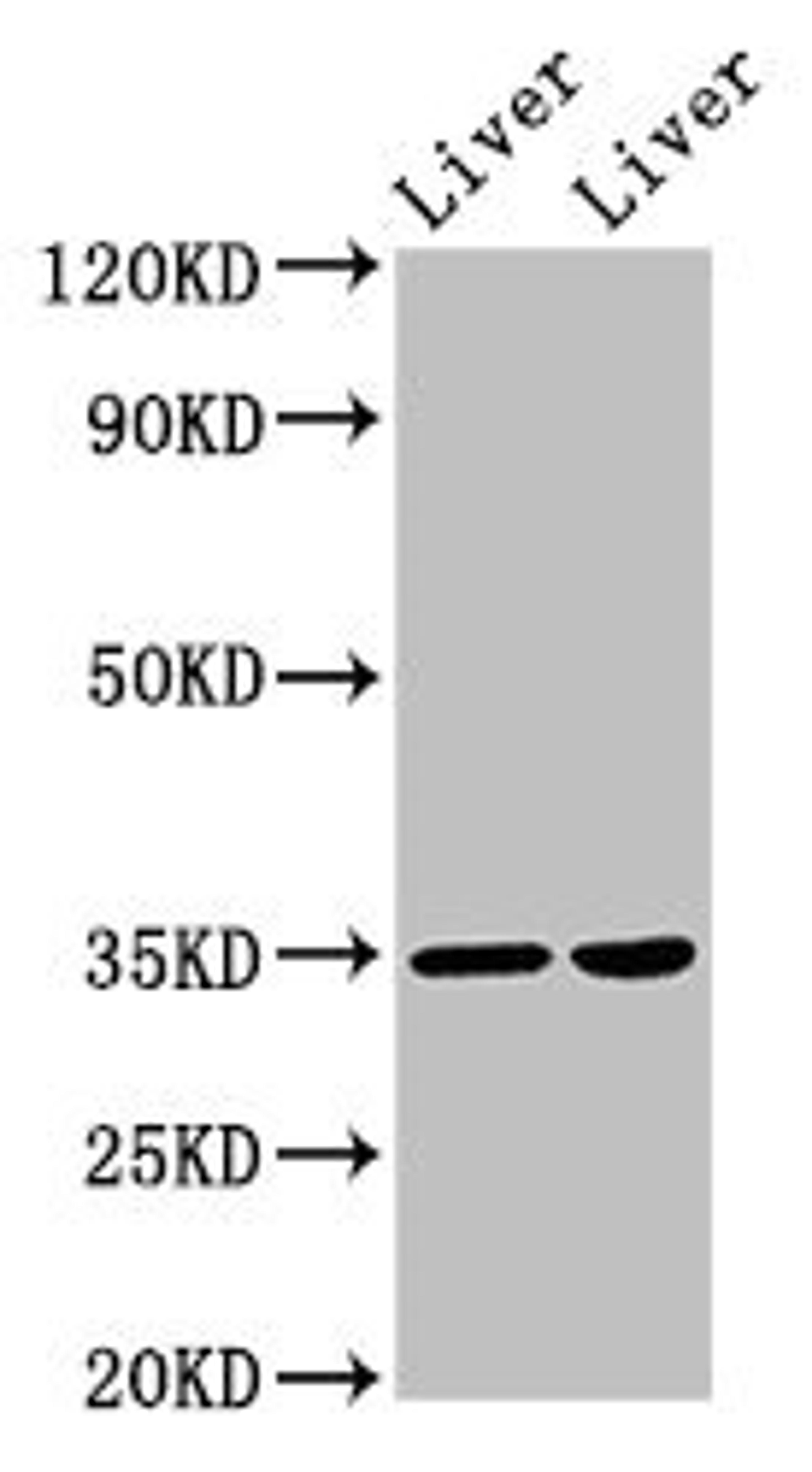 Western Blot. Positive WB detected in: Rat liver tissue, Mouse liver tissue. All lanes: NANOGP8 antibody at 2µg/ml. Secondary. Goat polyclonal to rabbit IgG at 1/50000 dilution. Predicted band size: 35 kDa. Observed band size: 35 kDa