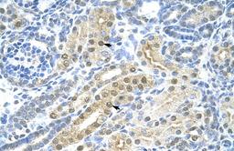 Antibody used in IHC on Human kidney.