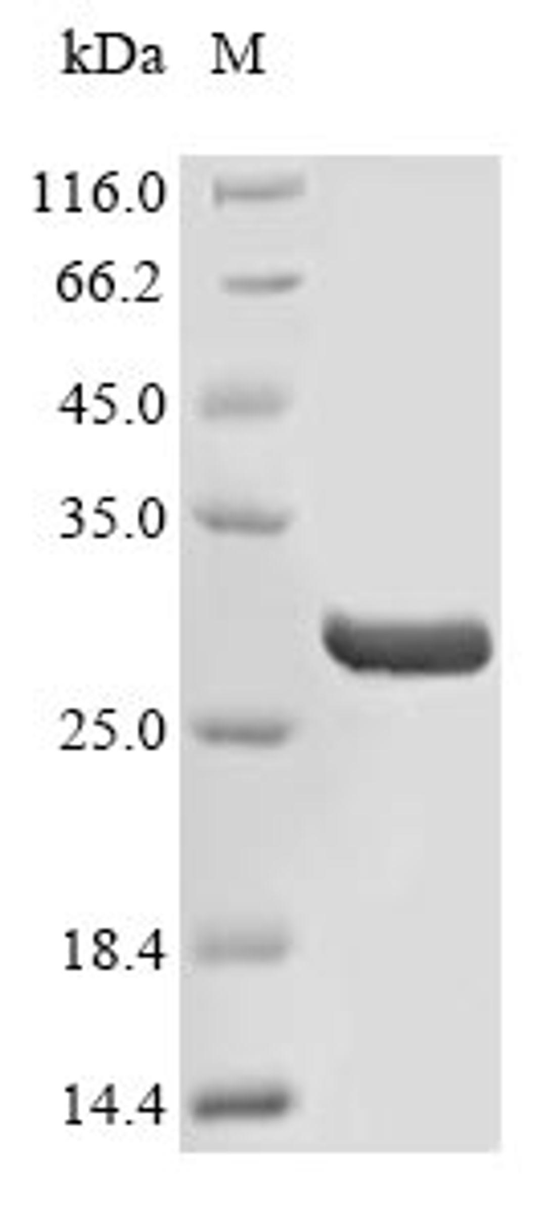 (Tris-Glycine gel) Discontinuous SDS-PAGE (reduced) with 5% enrichment gel and 15% separation gel.