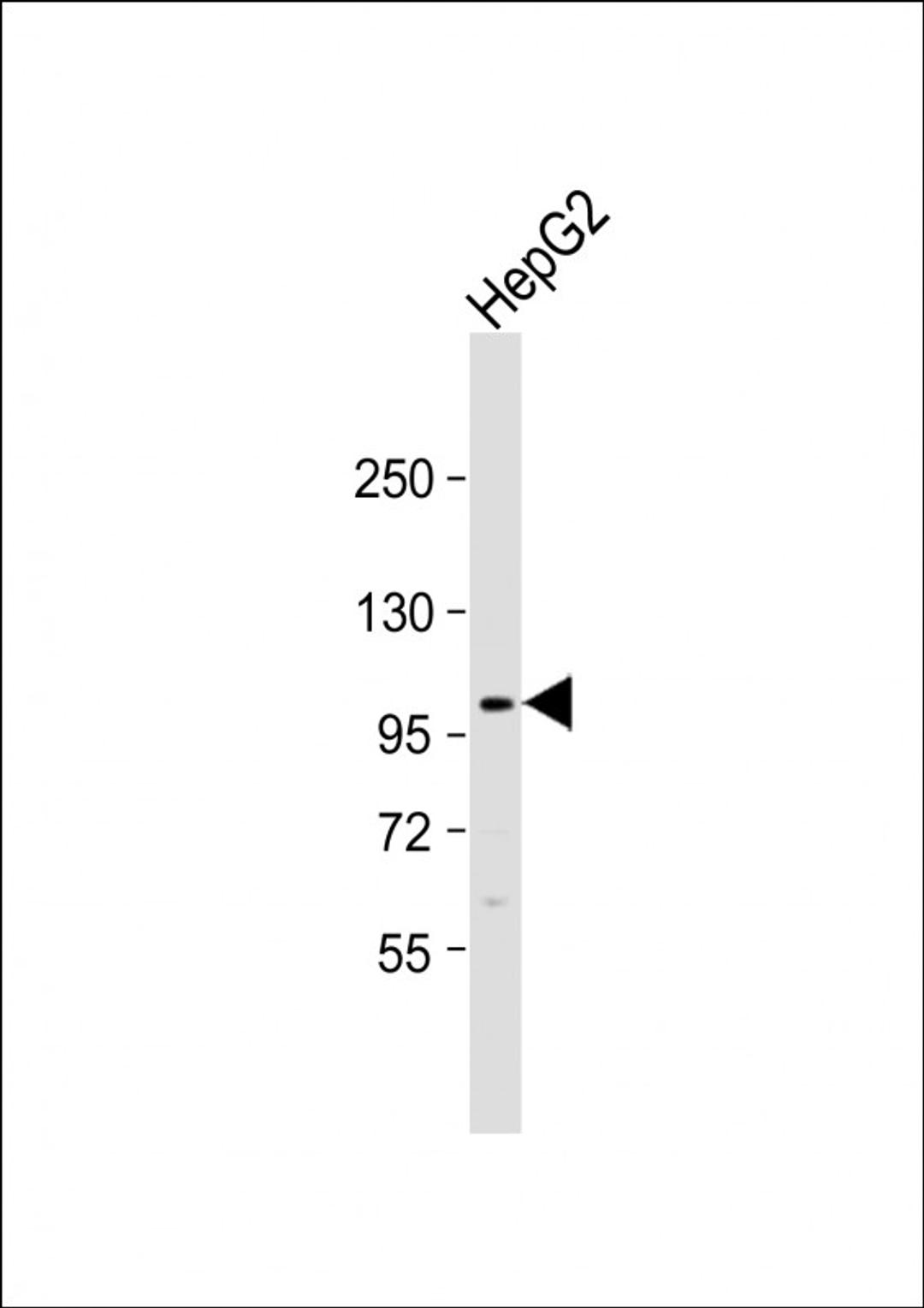 Western Blot at 1:1000 dilution + HepG2 whole cell lysate Lysates/proteins at 20 ug per lane.