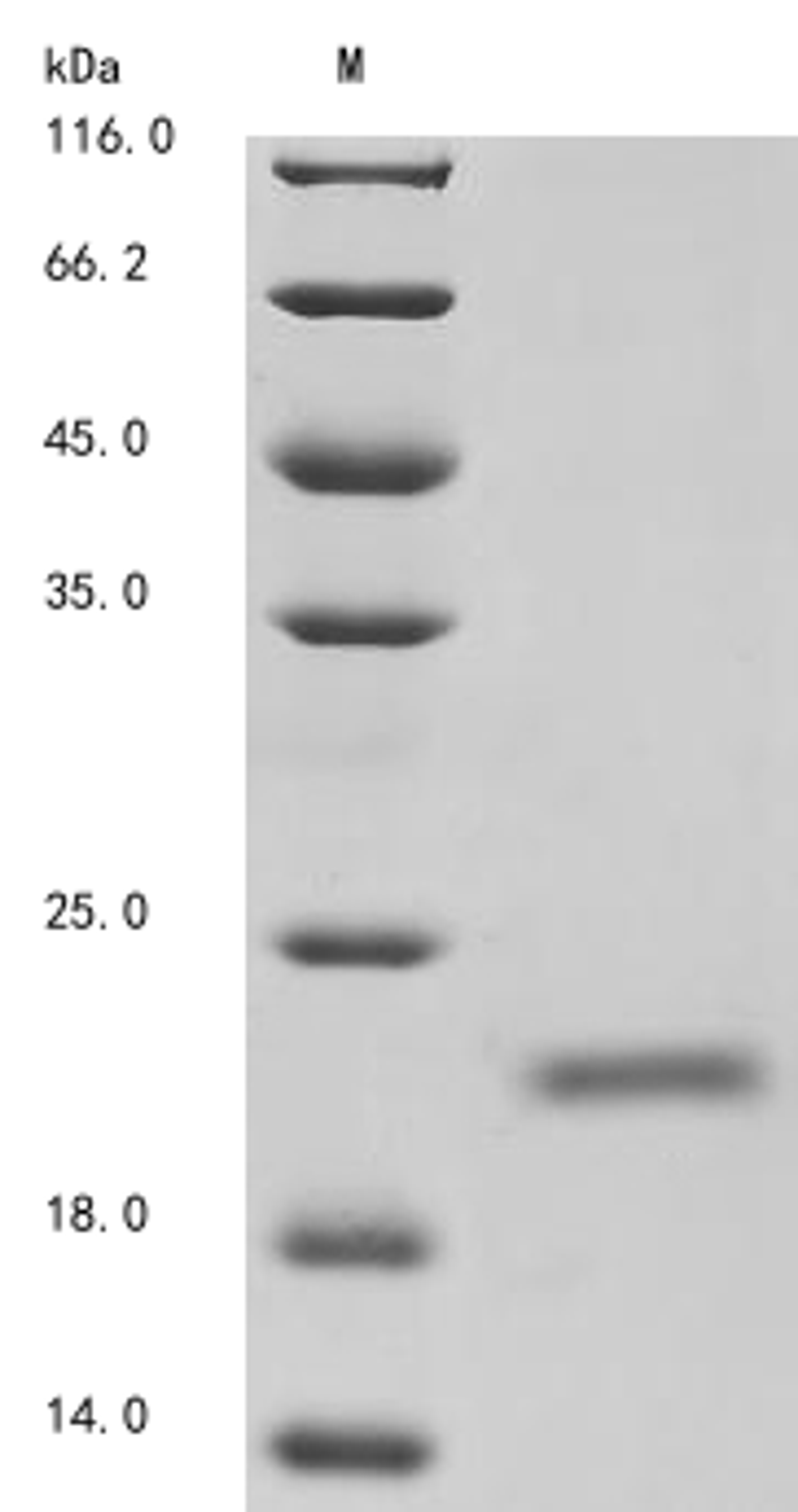 (Tris-Glycine gel) Discontinuous SDS-PAGE (reduced) with 5% enrichment gel and 15% separation gel.
