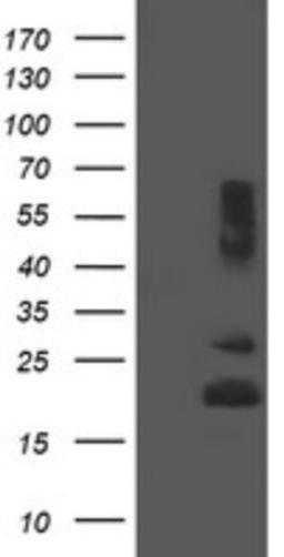 Western Blot: REEP5 Antibody (4D2) [NBP2-45945] - Analysis of HEK293T cells were transfected with the pCMV6-ENTRY control (Left lane) or pCMV6-ENTRY REEP5.