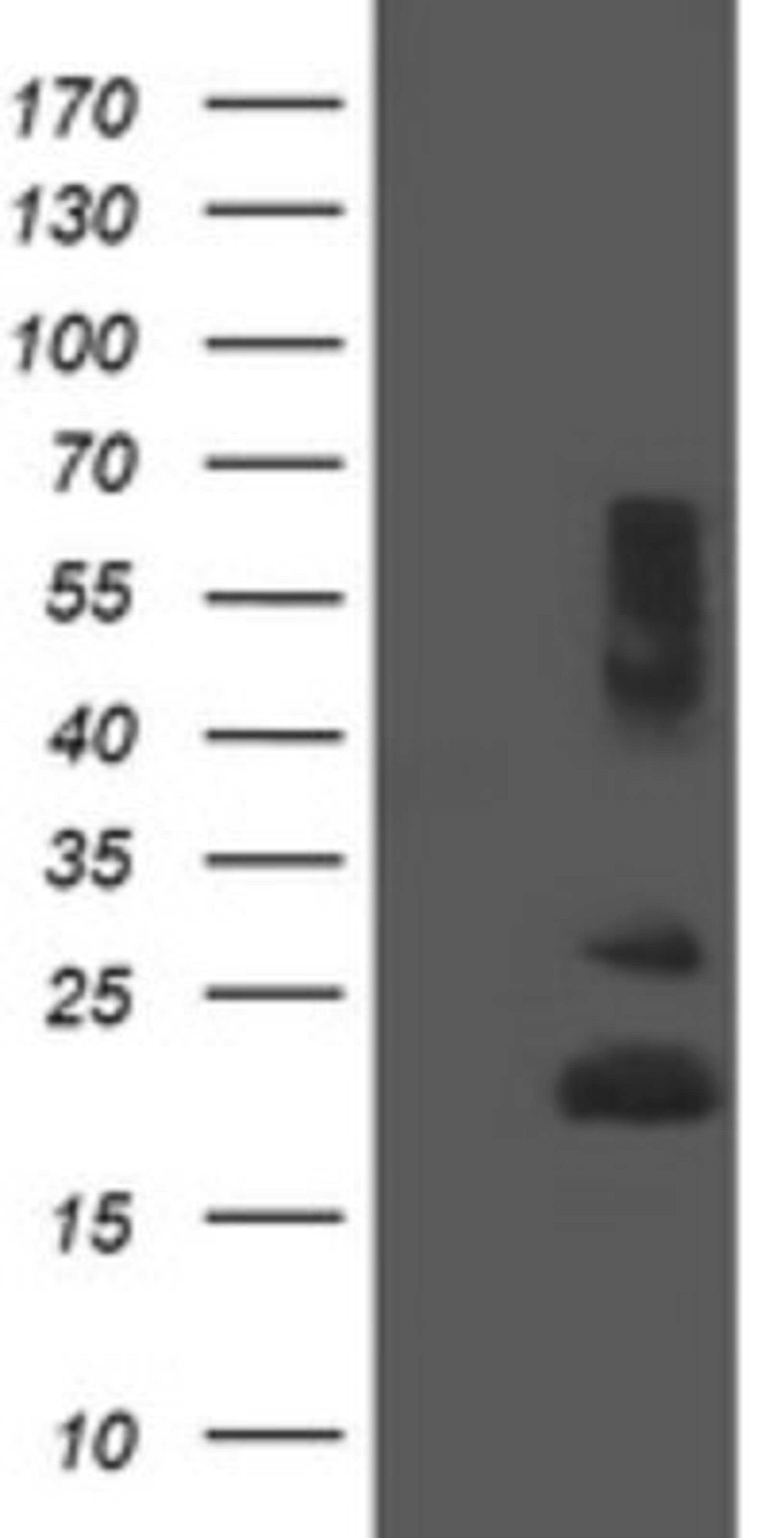 Western Blot: REEP5 Antibody (4D2) [NBP2-45945] - Analysis of HEK293T cells were transfected with the pCMV6-ENTRY control (Left lane) or pCMV6-ENTRY REEP5.