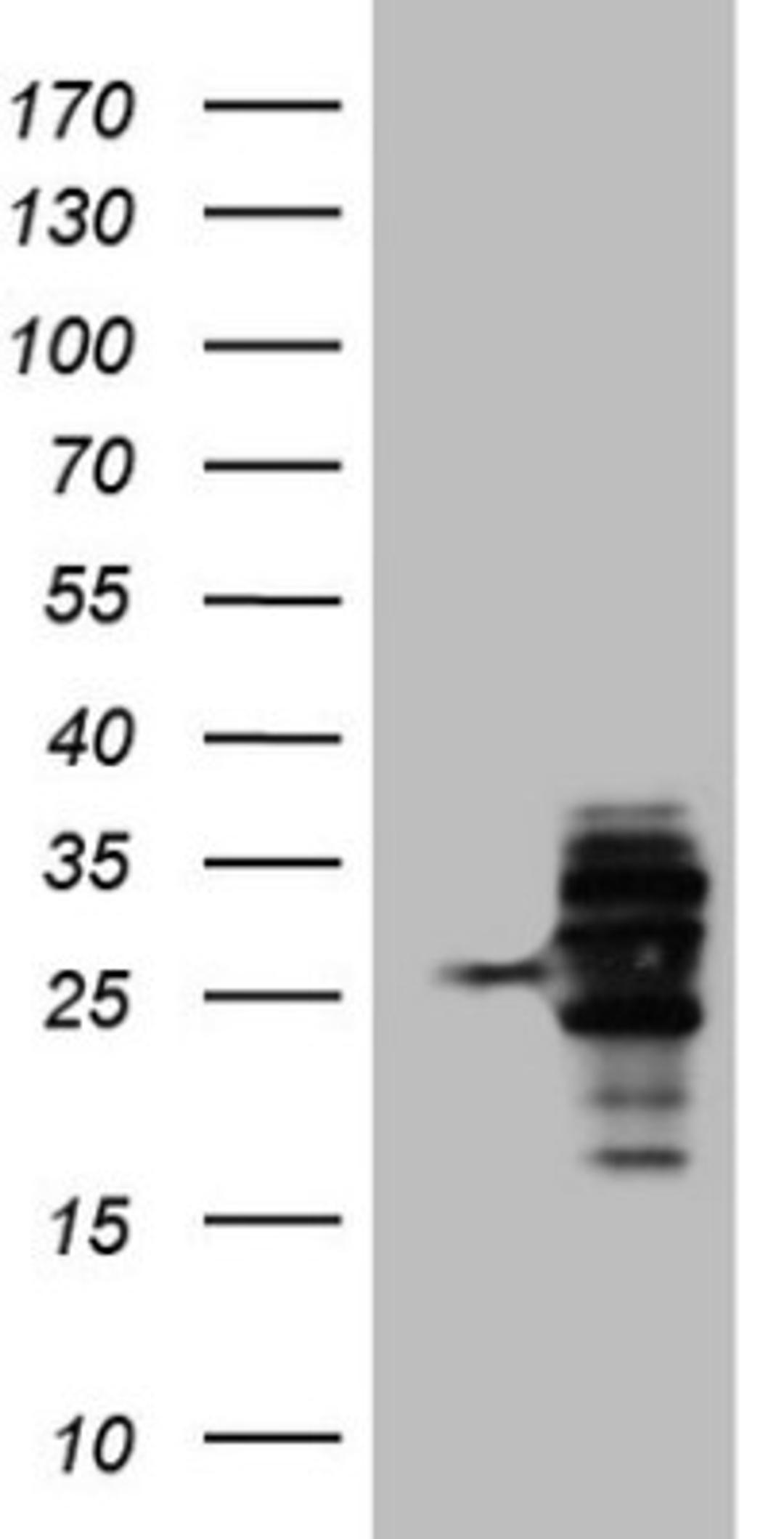 Western Blot: WIBG Antibody (5E2) [NBP2-46366] - Analysis of HEK293T cells were transfected with the pCMV6-ENTRY control (Left lane) or pCMV6-ENTRY WIBG.