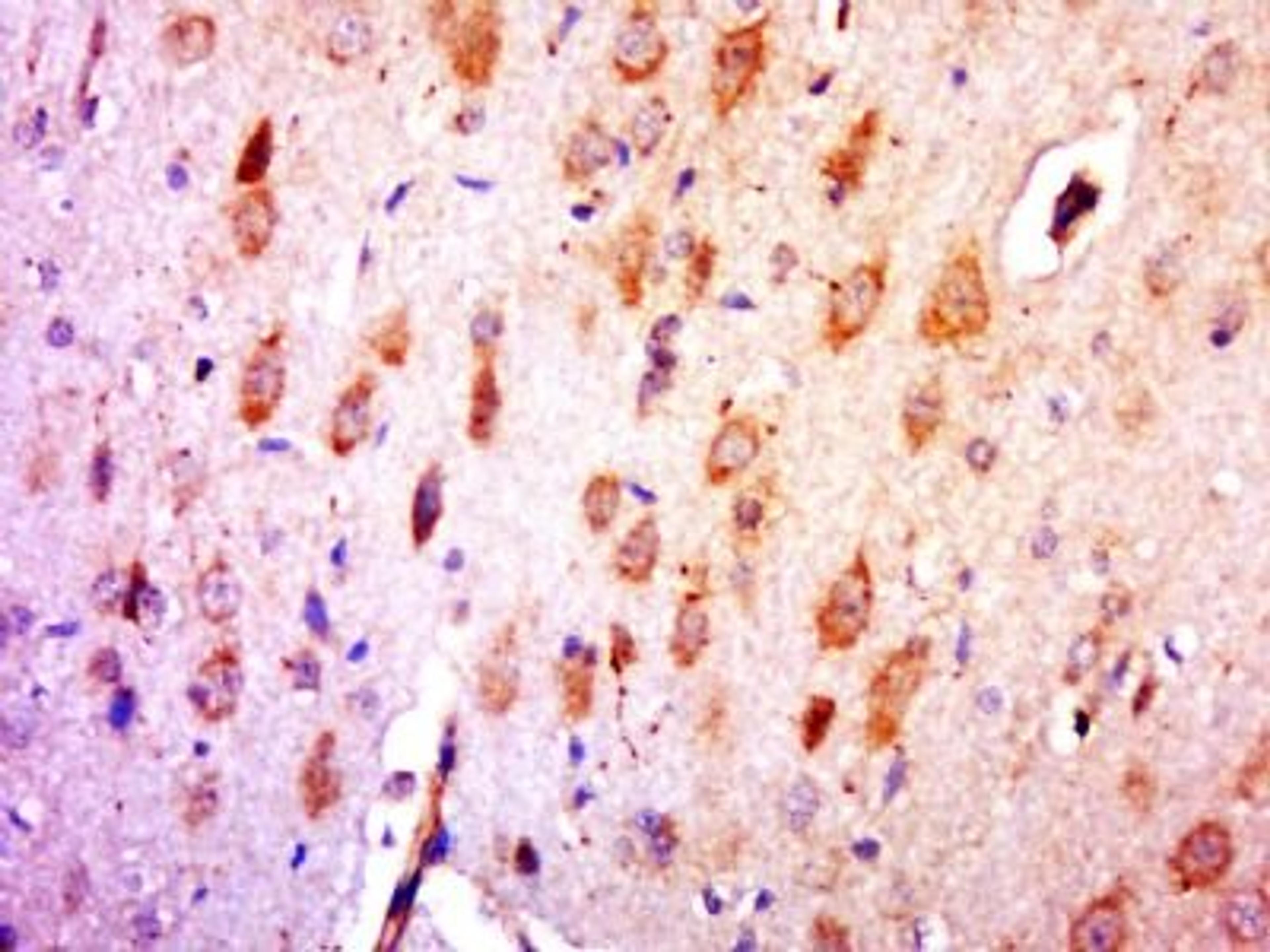 Immunohistochemical staining of rat brain tissue using INO80 antibody.