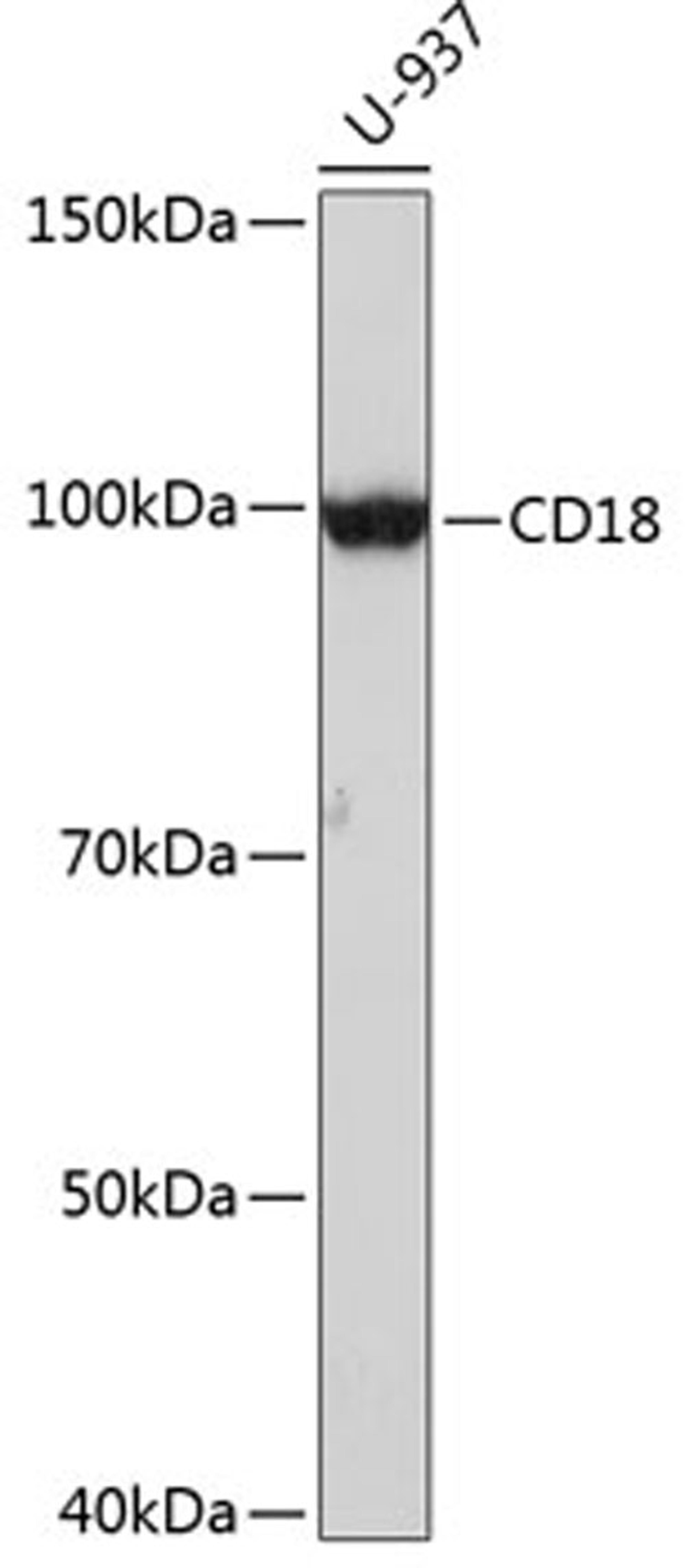 Western blot - CD18 antibody (A19012)