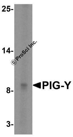 Western blot analysis of PIG-Y in human skeletal muscle tissue lysate with PIG-Y antibody at 5 &#956;g/mL.