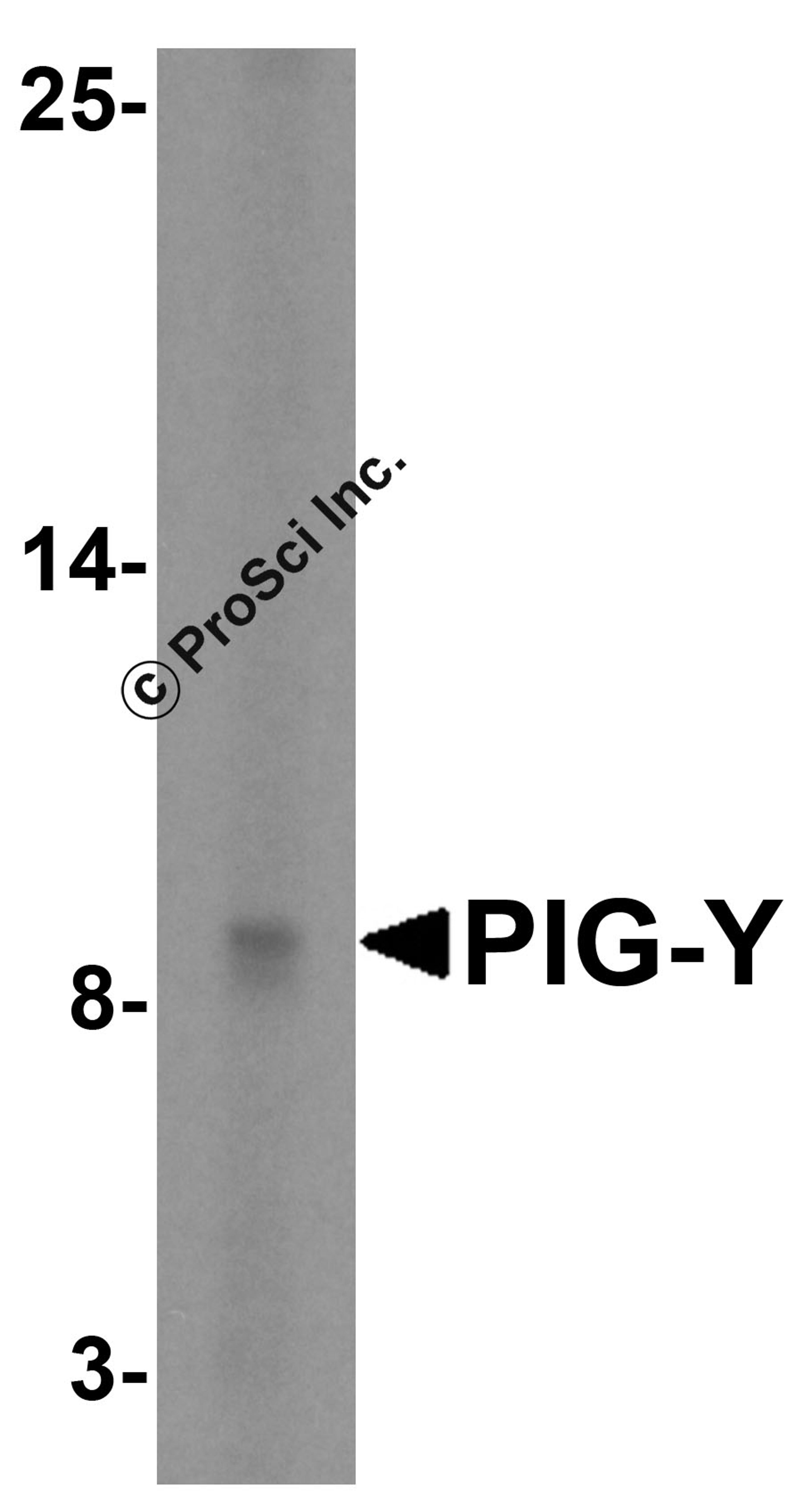 Western blot analysis of PIG-Y in human skeletal muscle tissue lysate with PIG-Y antibody at 5 &#956;g/mL.