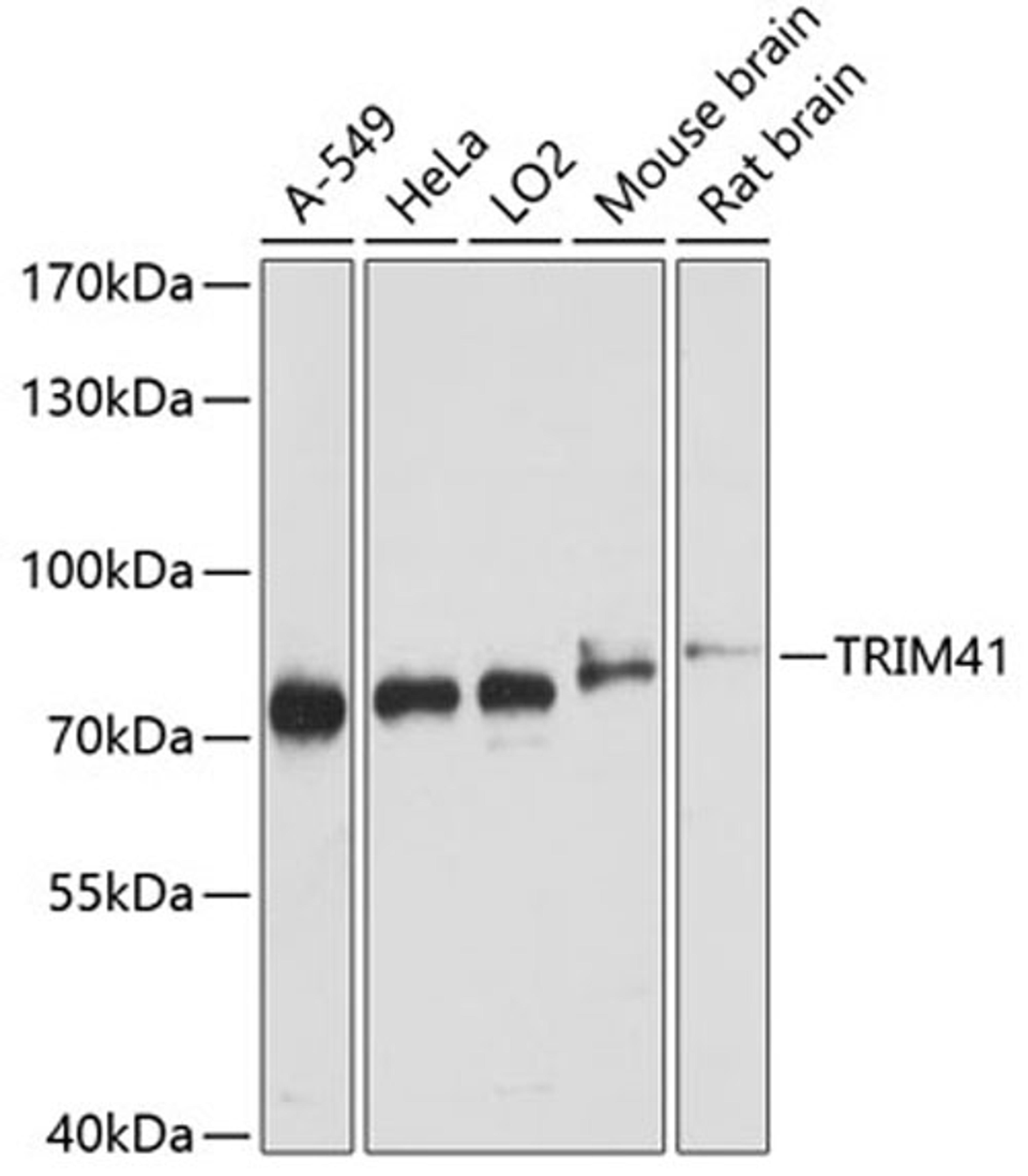 Western blot - TRIM41 antibody (A3538)