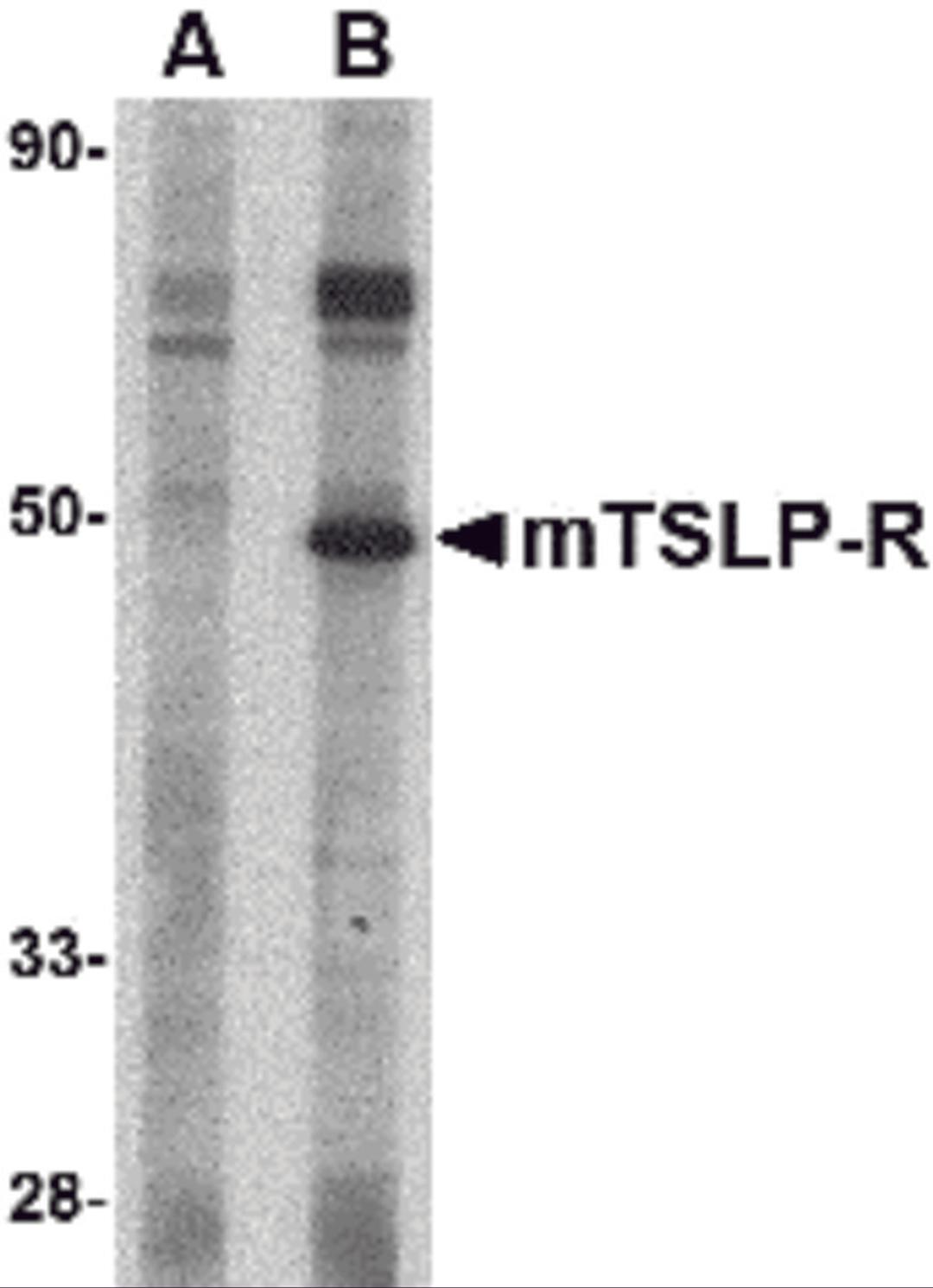 Western blot analysis of TSLP Receptor in mouse heart tissue lysate with TSLP Receptor antibody at 1 &#956;g/mL in (A) the presence and (B) the absence of blocking peptide.