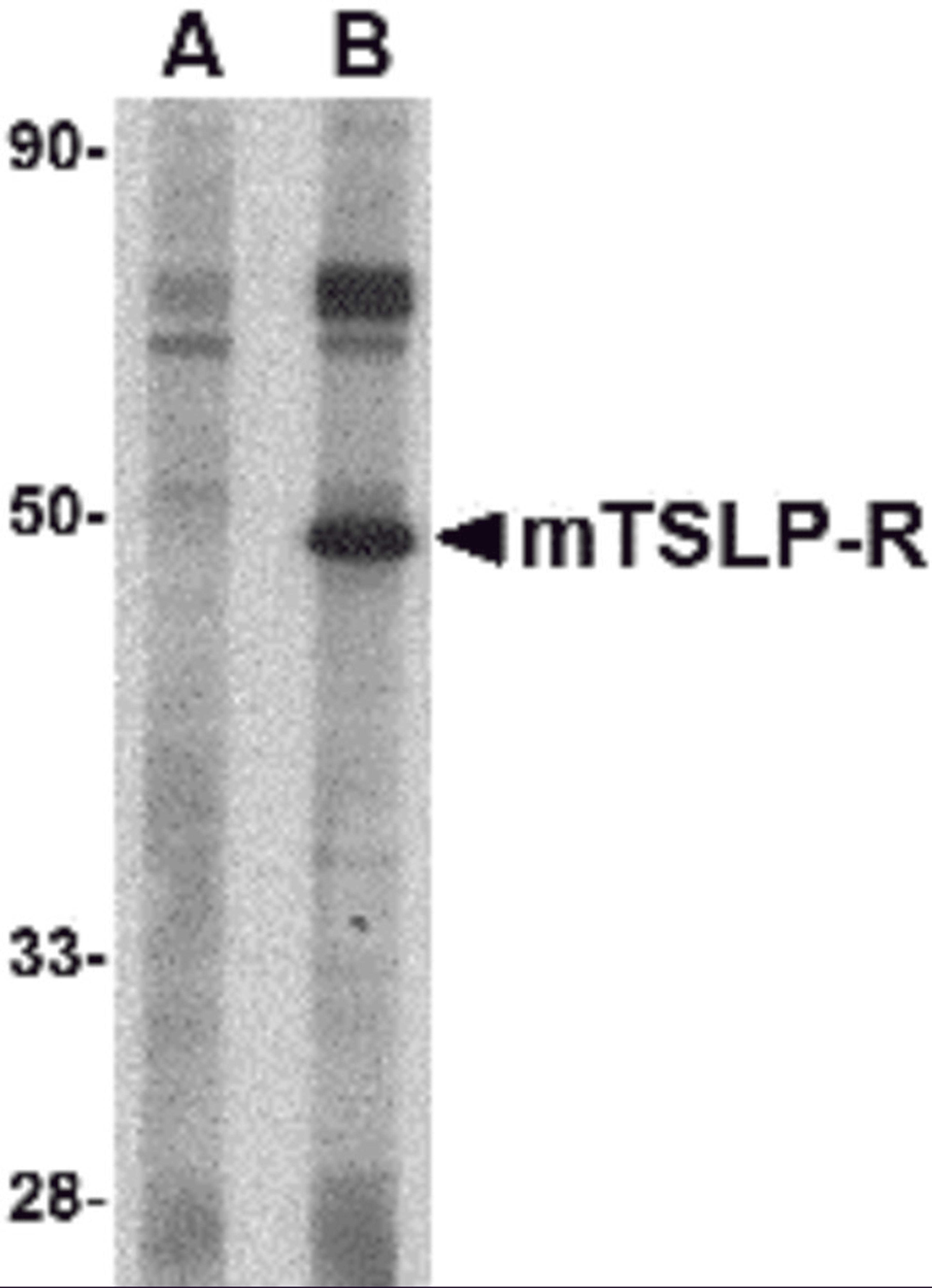 Western blot analysis of TSLP Receptor in mouse heart tissue lysate with TSLP Receptor antibody at 1 &#956;g/mL in (A) the presence and (B) the absence of blocking peptide.