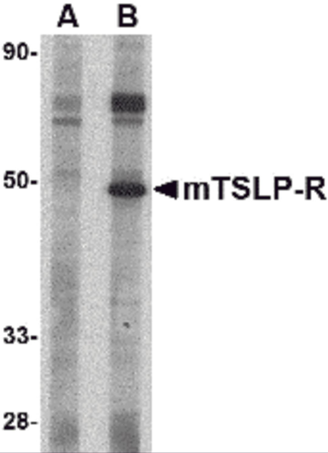 Western blot analysis of TSLP Receptor in mouse heart tissue lysate with TSLP Receptor antibody at 1 μg/mL in (A) the presence and (B) the absence of blocking peptide.