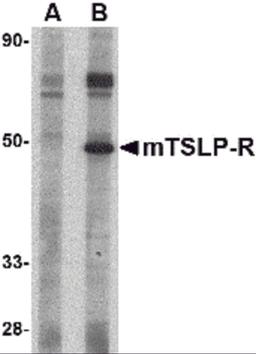 Western blot analysis of TSLP Receptor in mouse heart tissue lysate with TSLP Receptor antibody at 1 μg/mL in (A) the presence and (B) the absence of blocking peptide.
