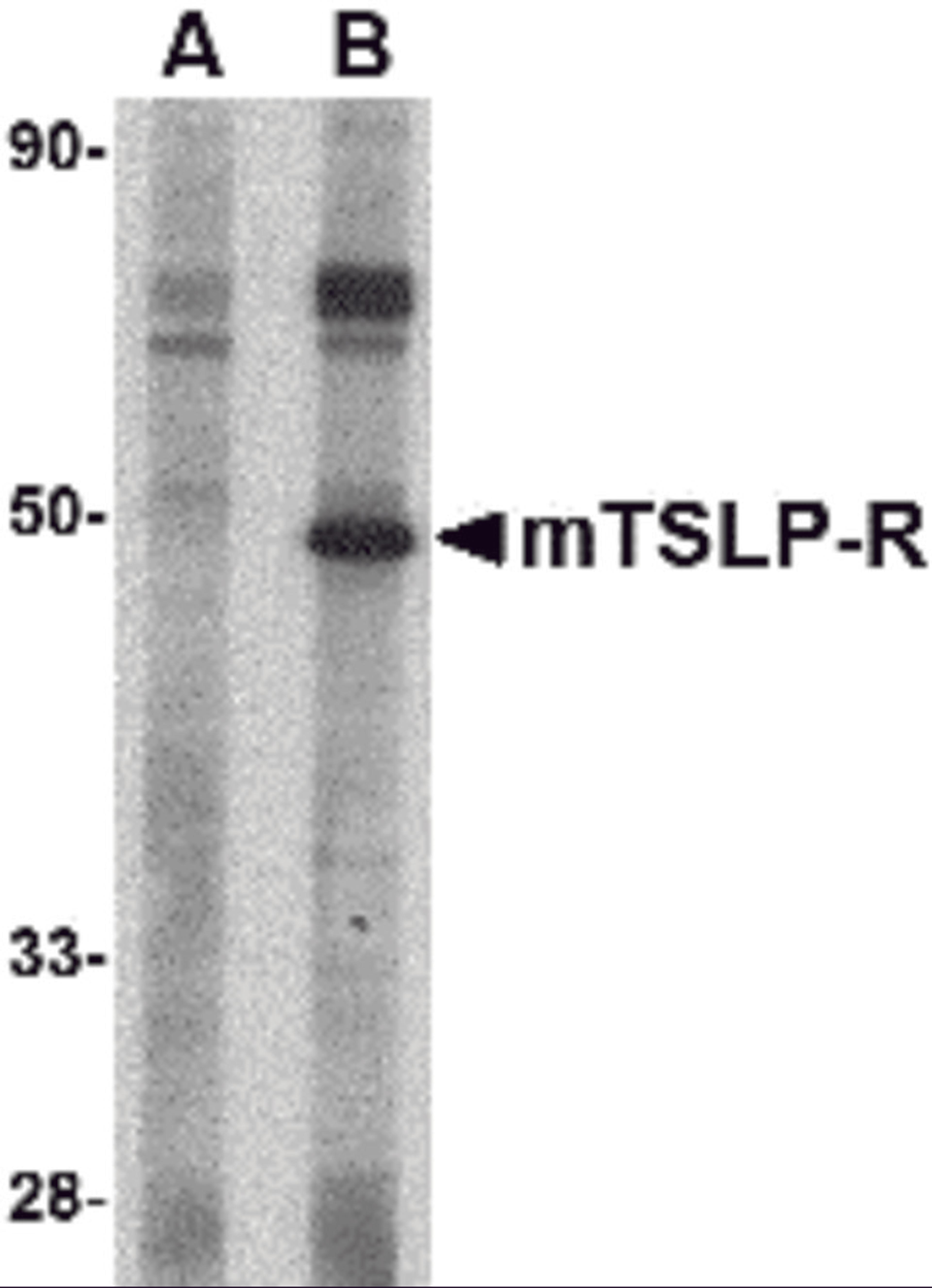 Western blot analysis of TSLP Receptor in mouse heart tissue lysate with TSLP Receptor antibody at 1 μg/mL in (A) the presence and (B) the absence of blocking peptide.