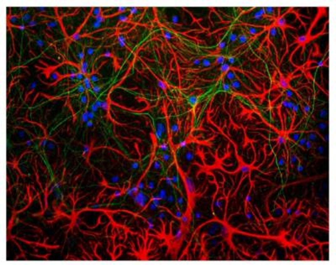 Immunocytochemistry/Immunofluorescence: GFAP Antibody (5C10) [NBP1-05197] - Mixed neuron-glial cultures stained with NBP1-05197, and chicken polyclonal antibody to neurofilament NF-L NBP1-05219 (green). The GFAP antibody stains the network of astrocytes in these cultures, while the NF-L antibody stains neurons and their processes. The blue channel shows the localization of DNA.